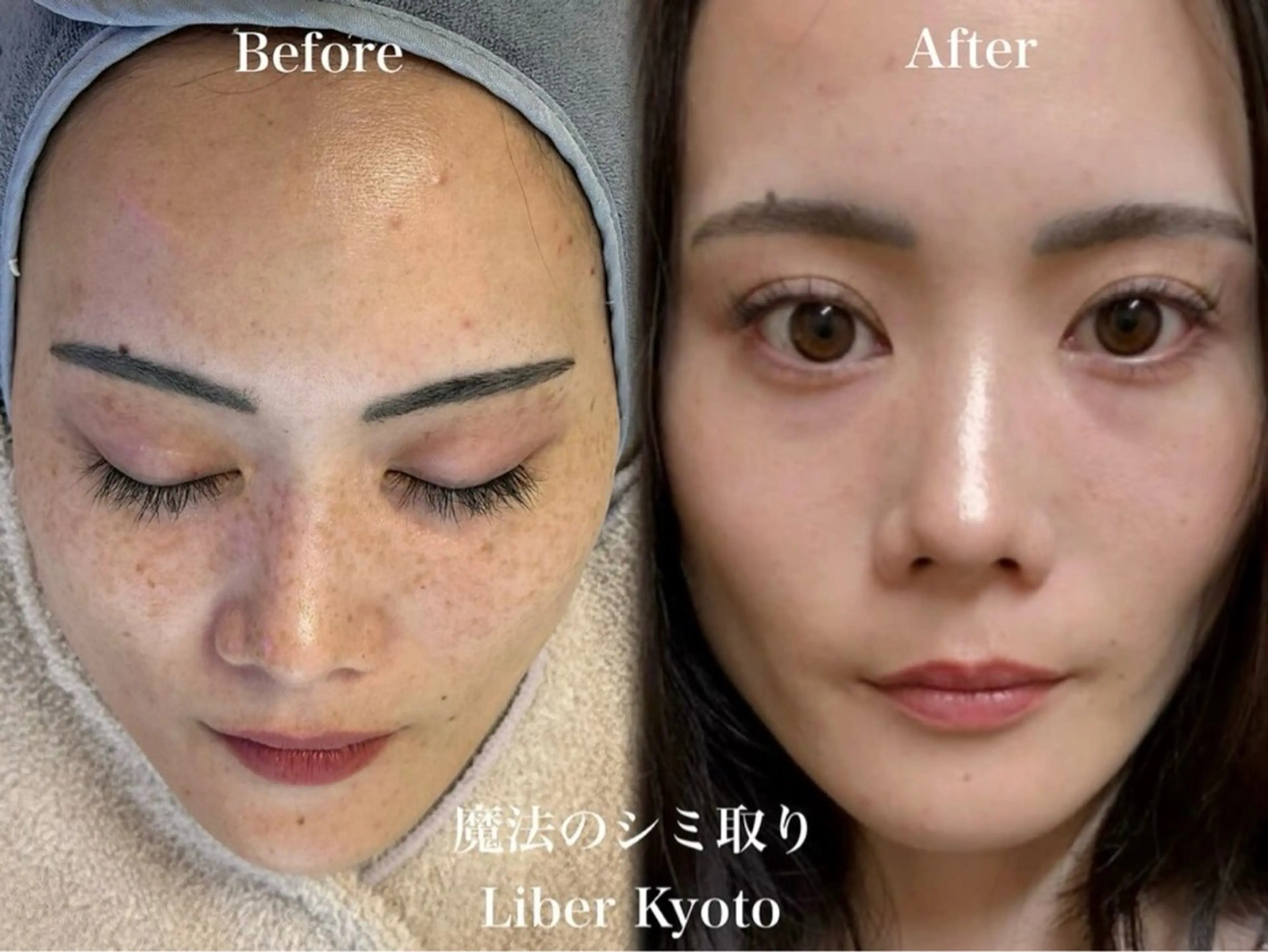 Liber CHIKAのエステ・リラクイメージ