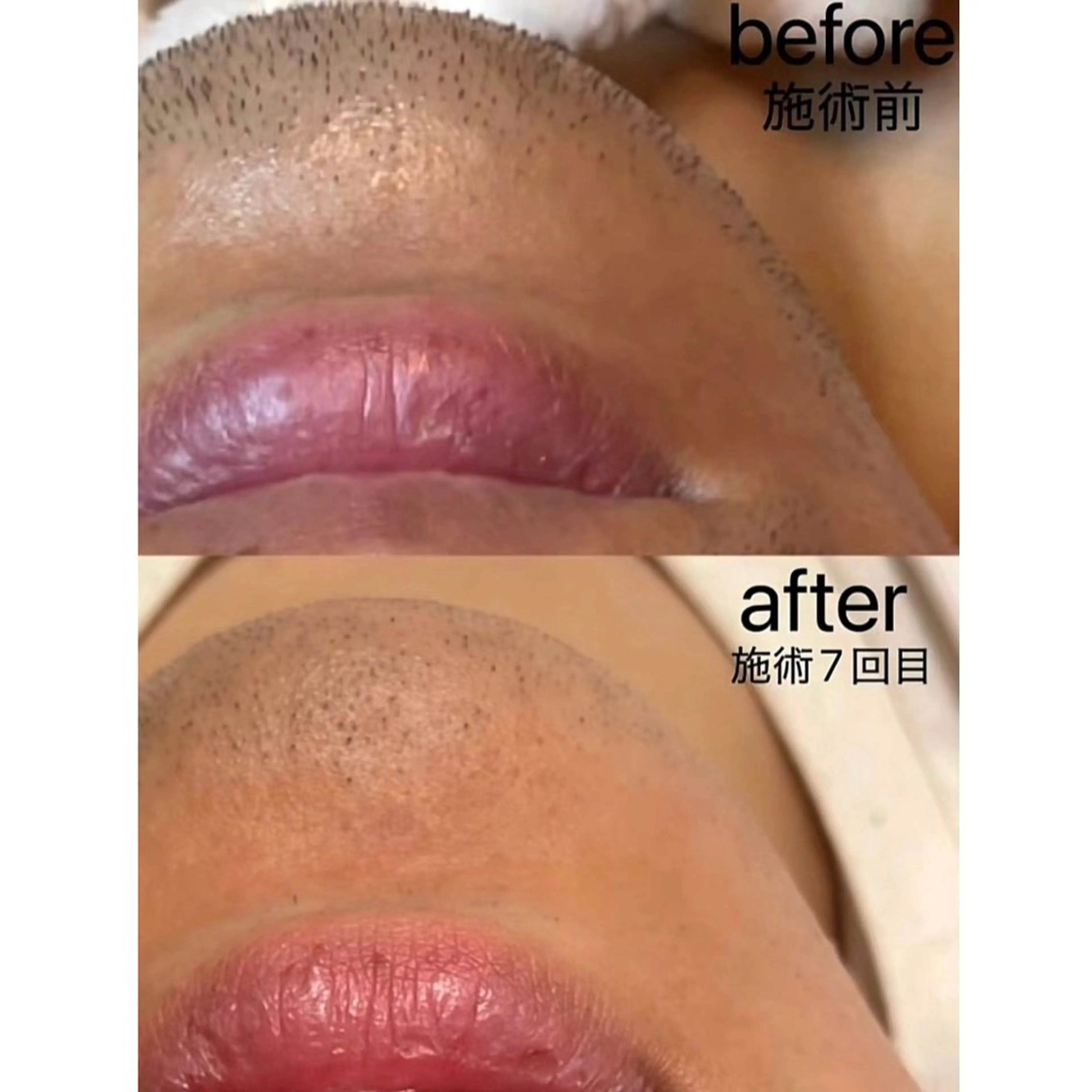 脱毛 KA PILINAのエステ・リラクイメージ