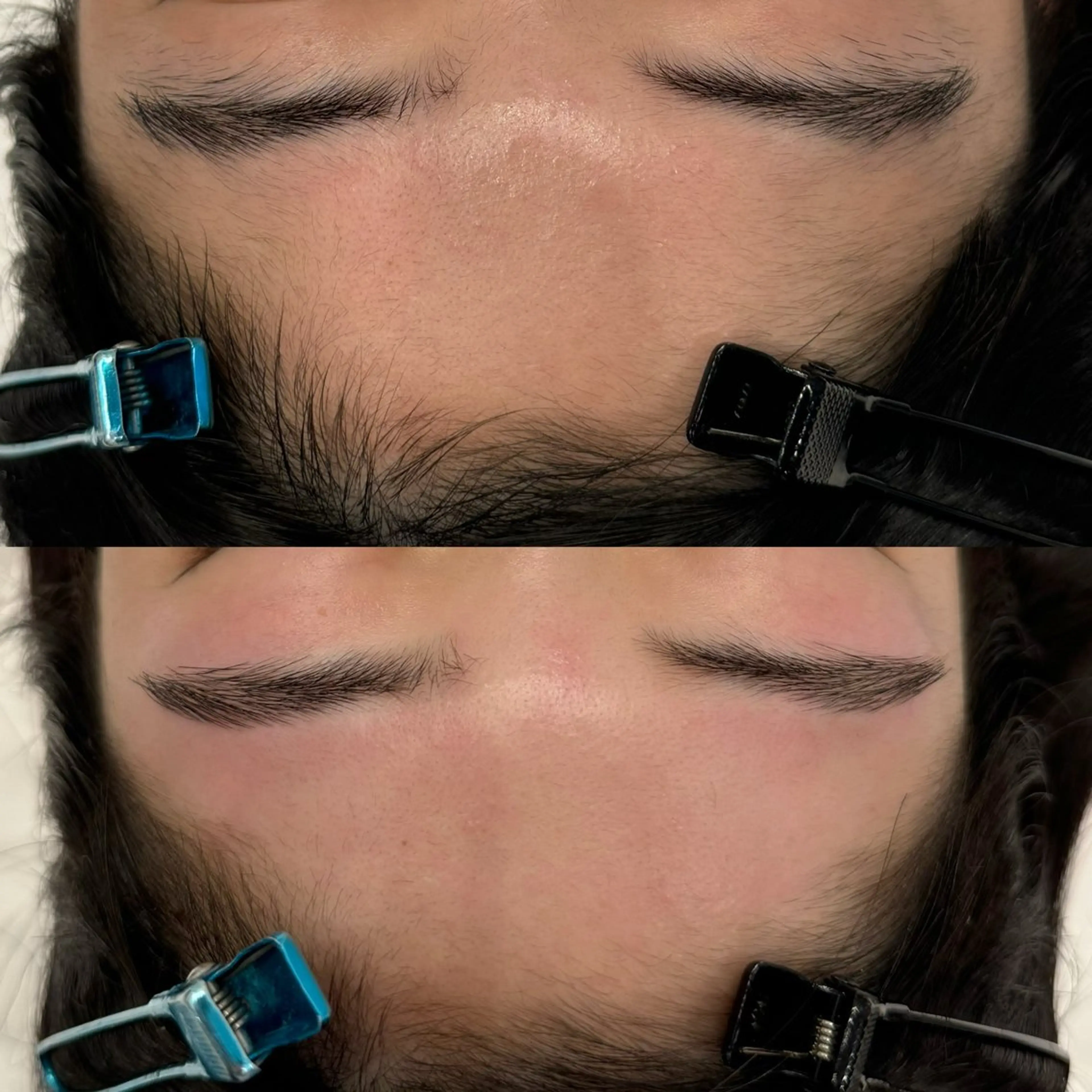 小顔/毛穴/ニキビ salon bealのエステ・リラクイメージ