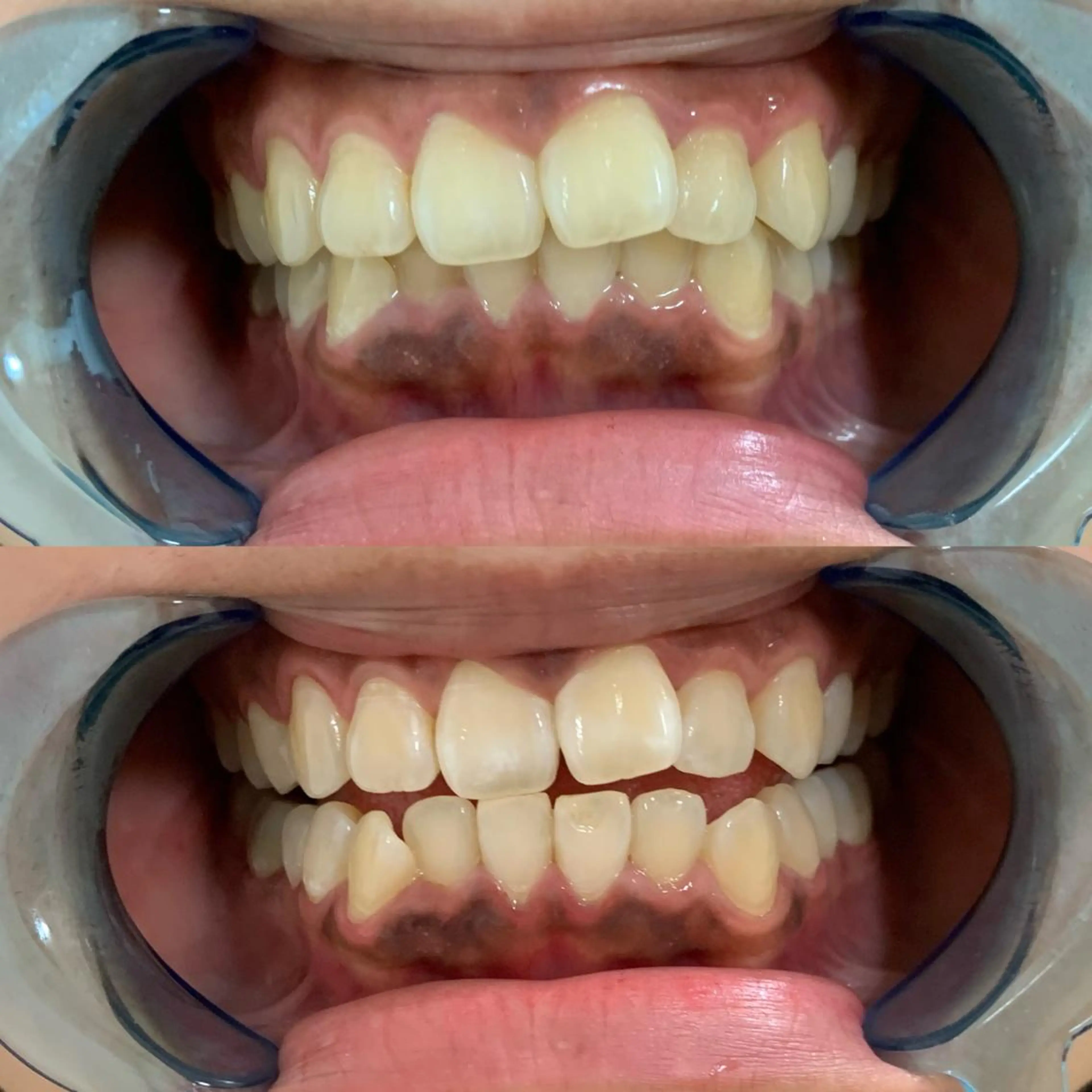 その他 藤本 真心のネイルデザイン