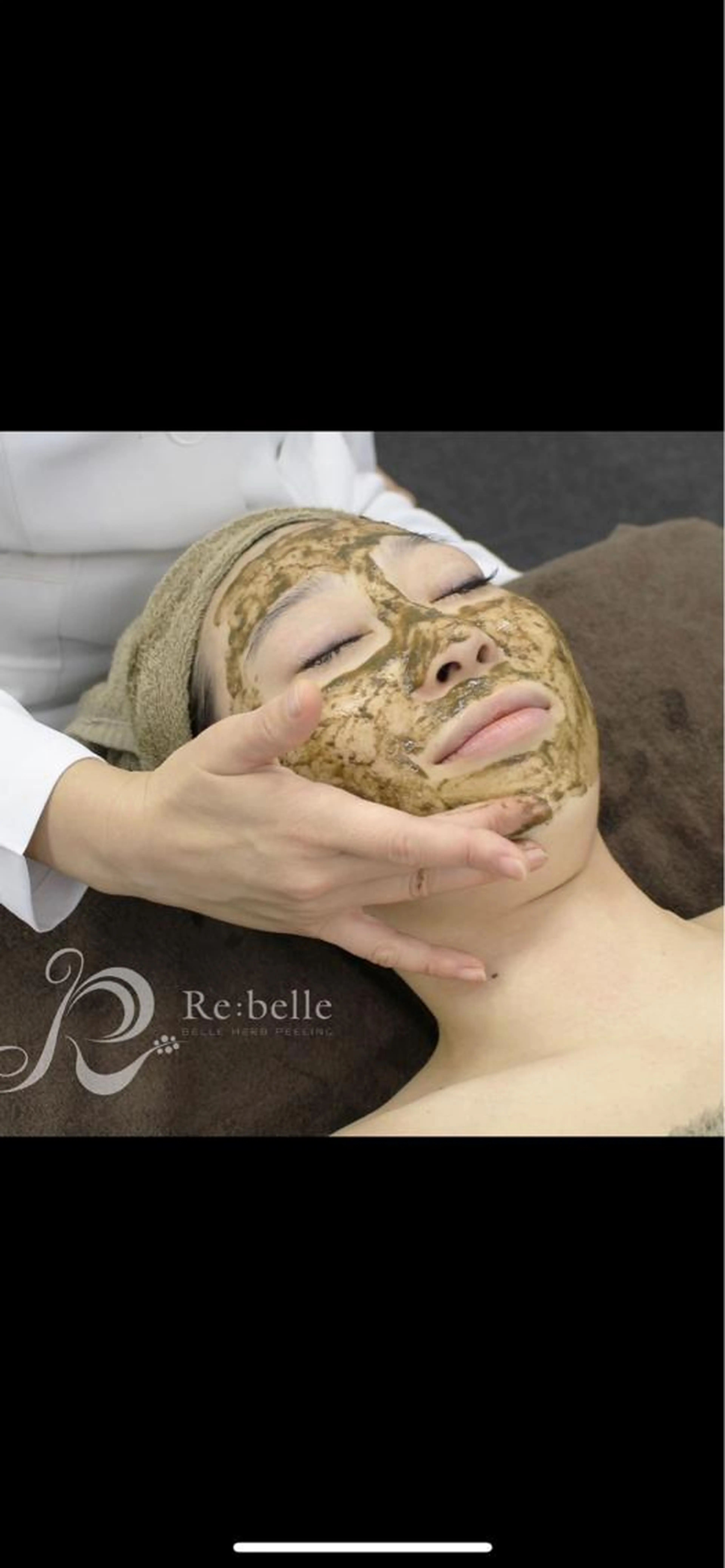 メンズ剥ける!ハーブピーリングで肌改善&光脱毛お試し照射付の写真