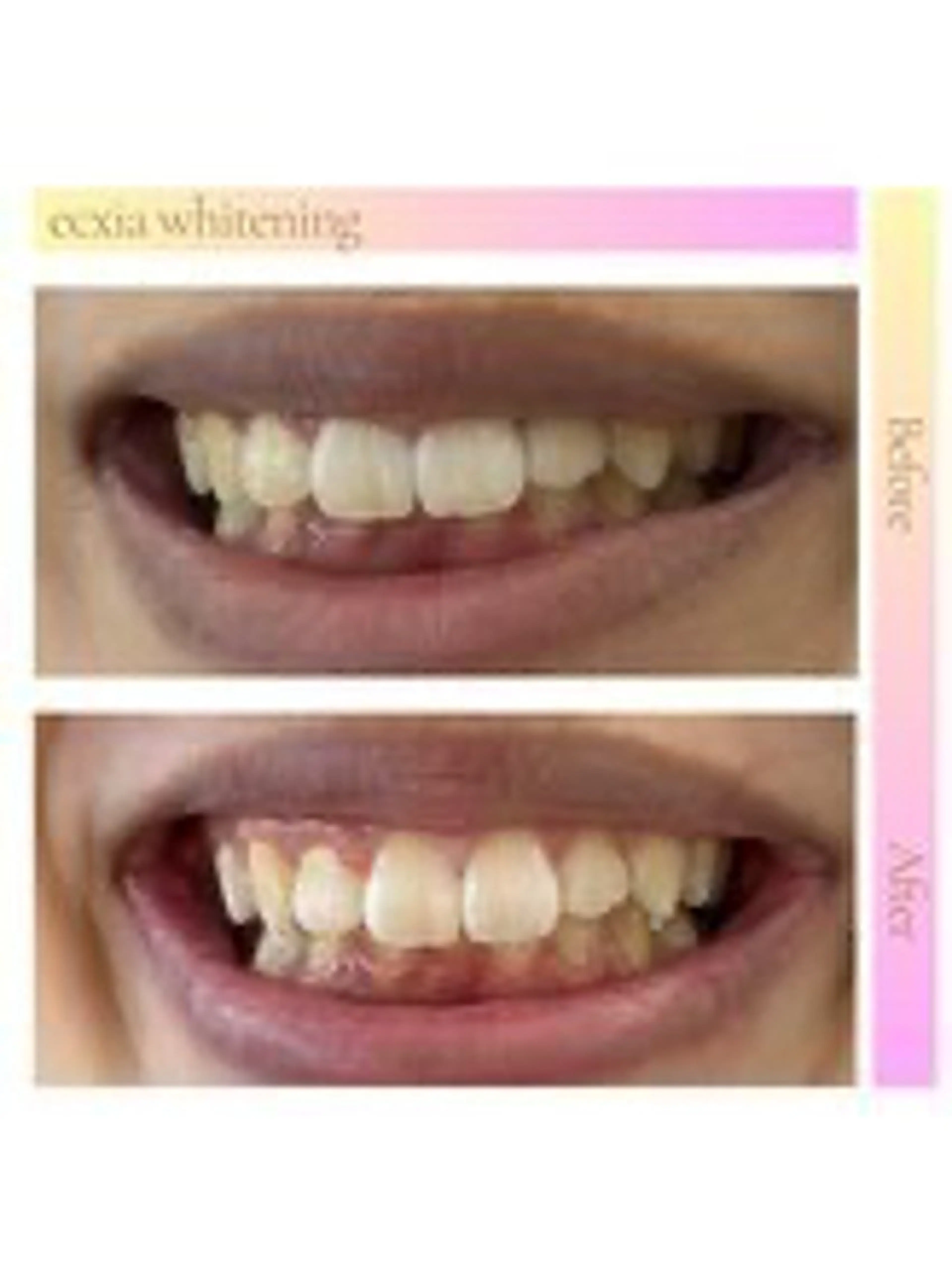 セルフホワイトニング エクシア西宮北口店所属・セルフホワイトニング エクシア西宮北口店のその他イメージ