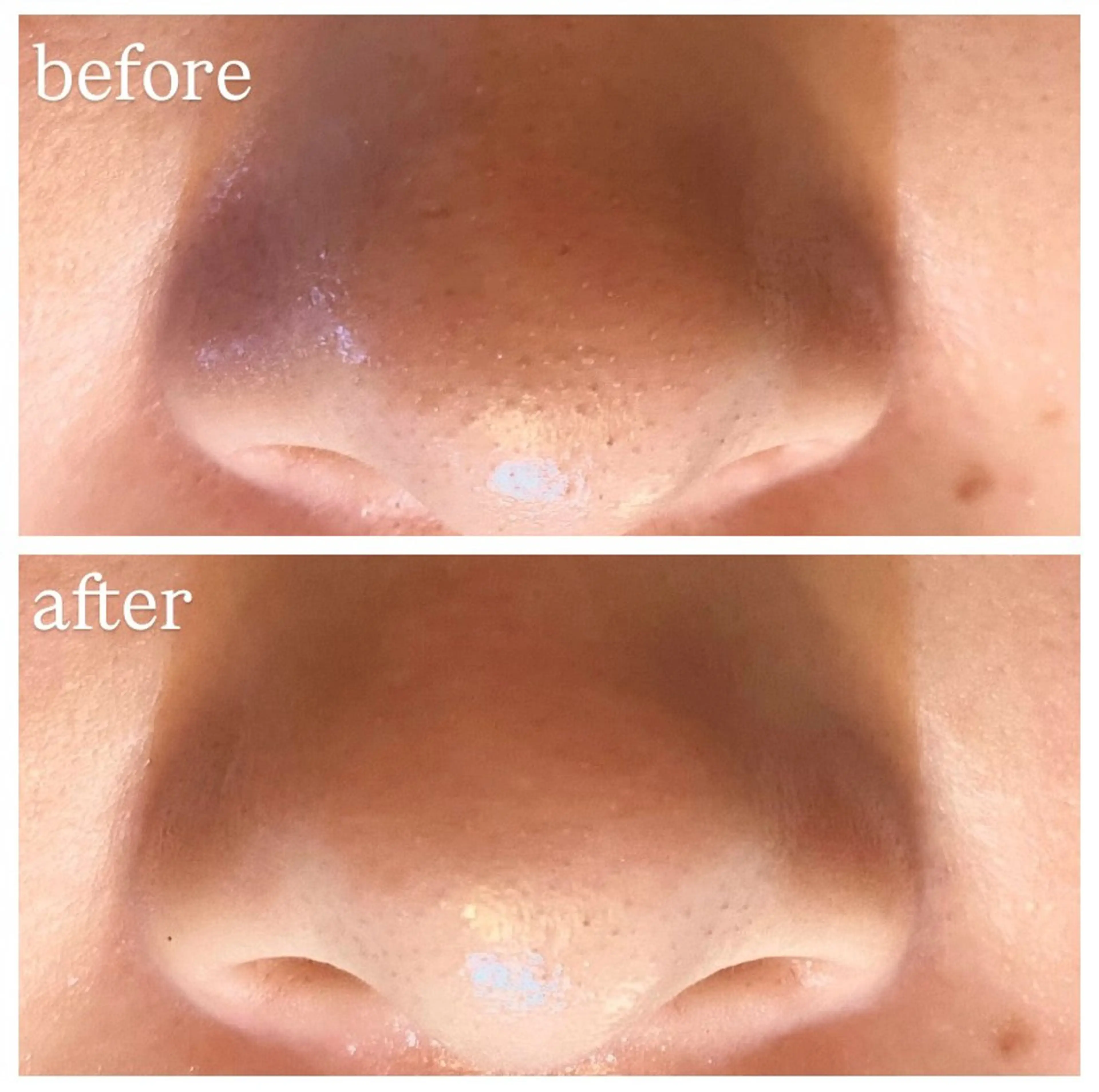 肌質改善専門 ハーブ /毛穴洗浄 リエイトのエステ・リラクイメージ