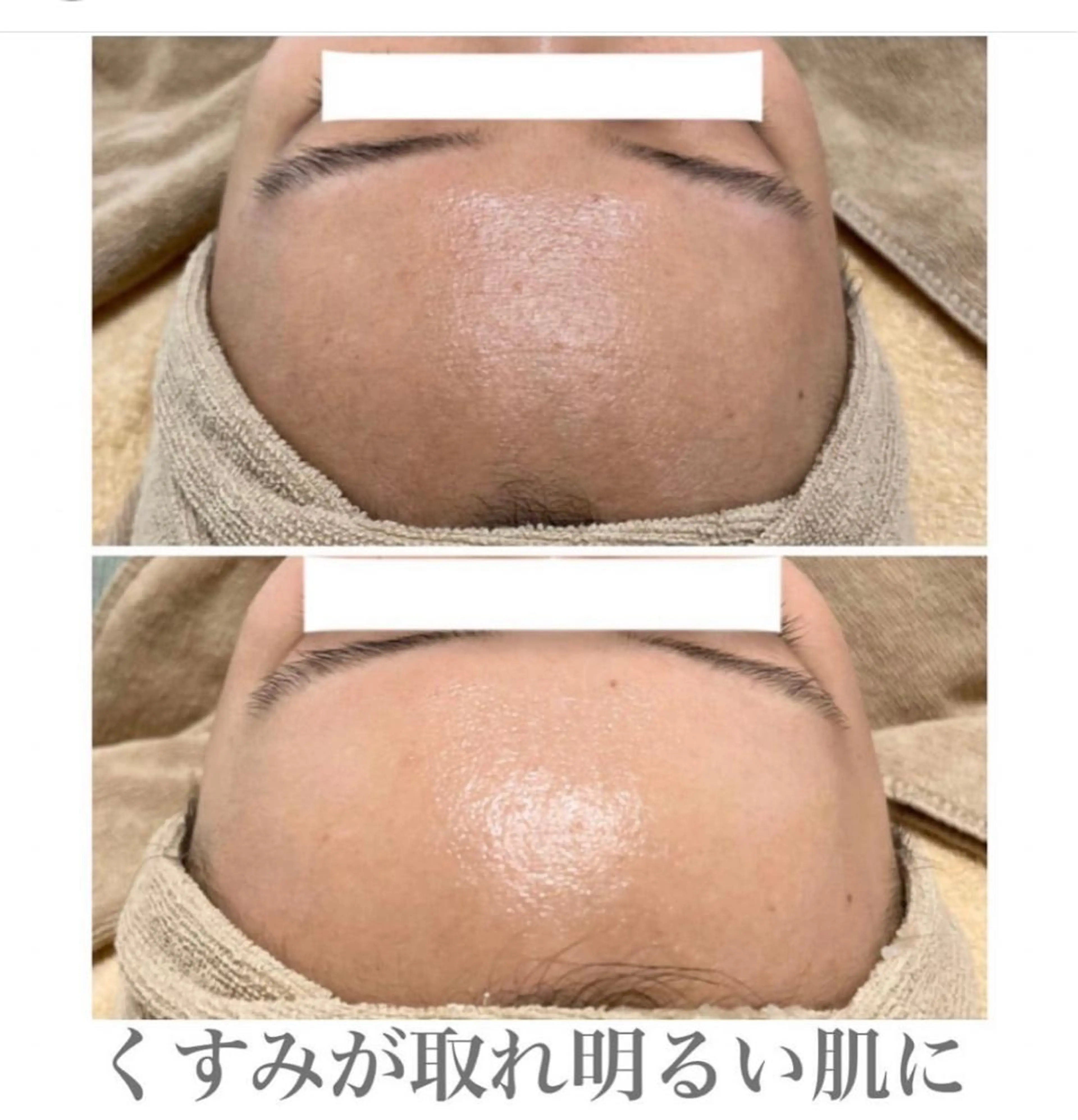 脱毛 エステサロン Mi-mi.iのエステ・リラクイメージ