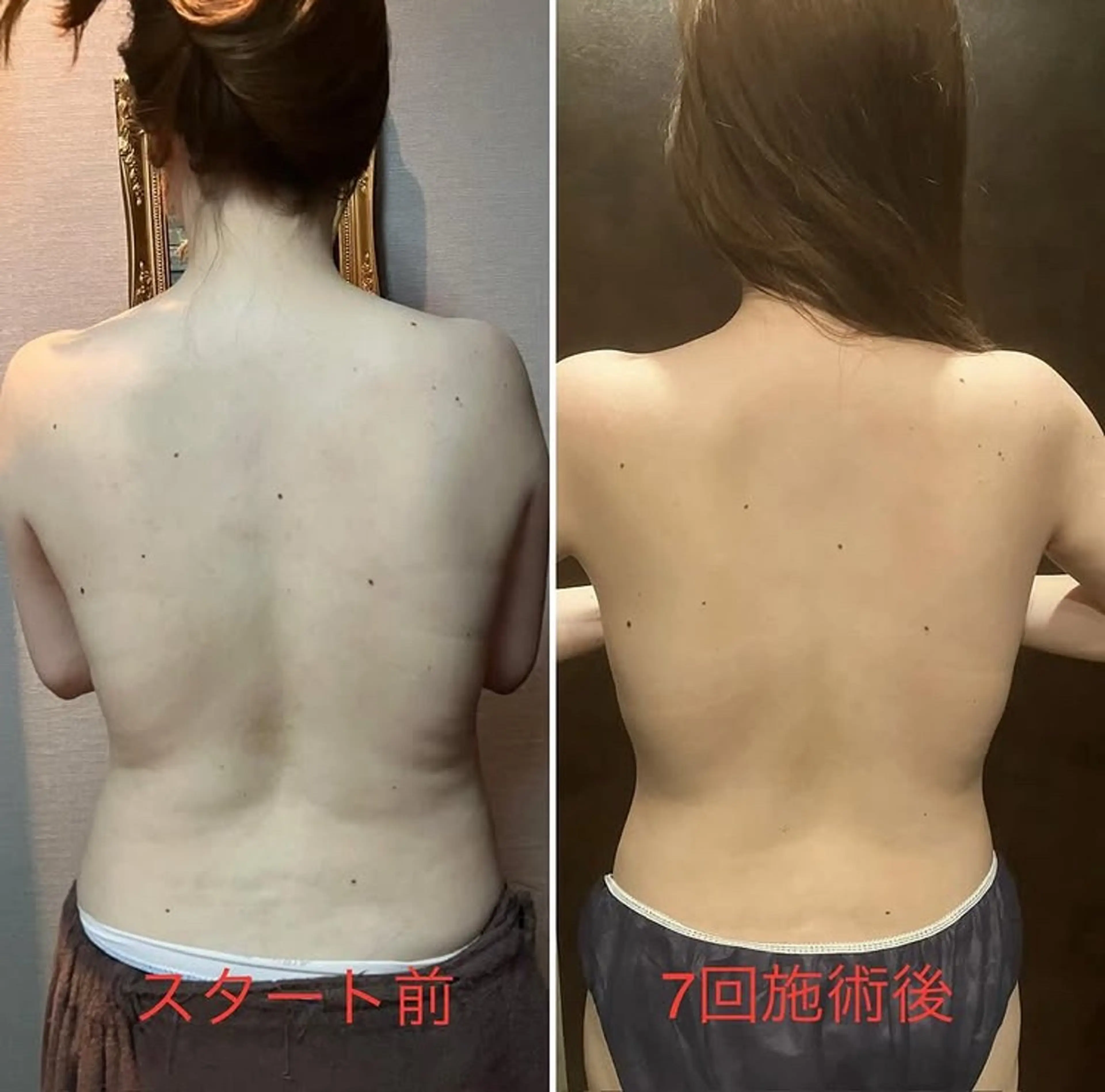 エステ リラク アイリー サロンのエステ・リラクイメージ