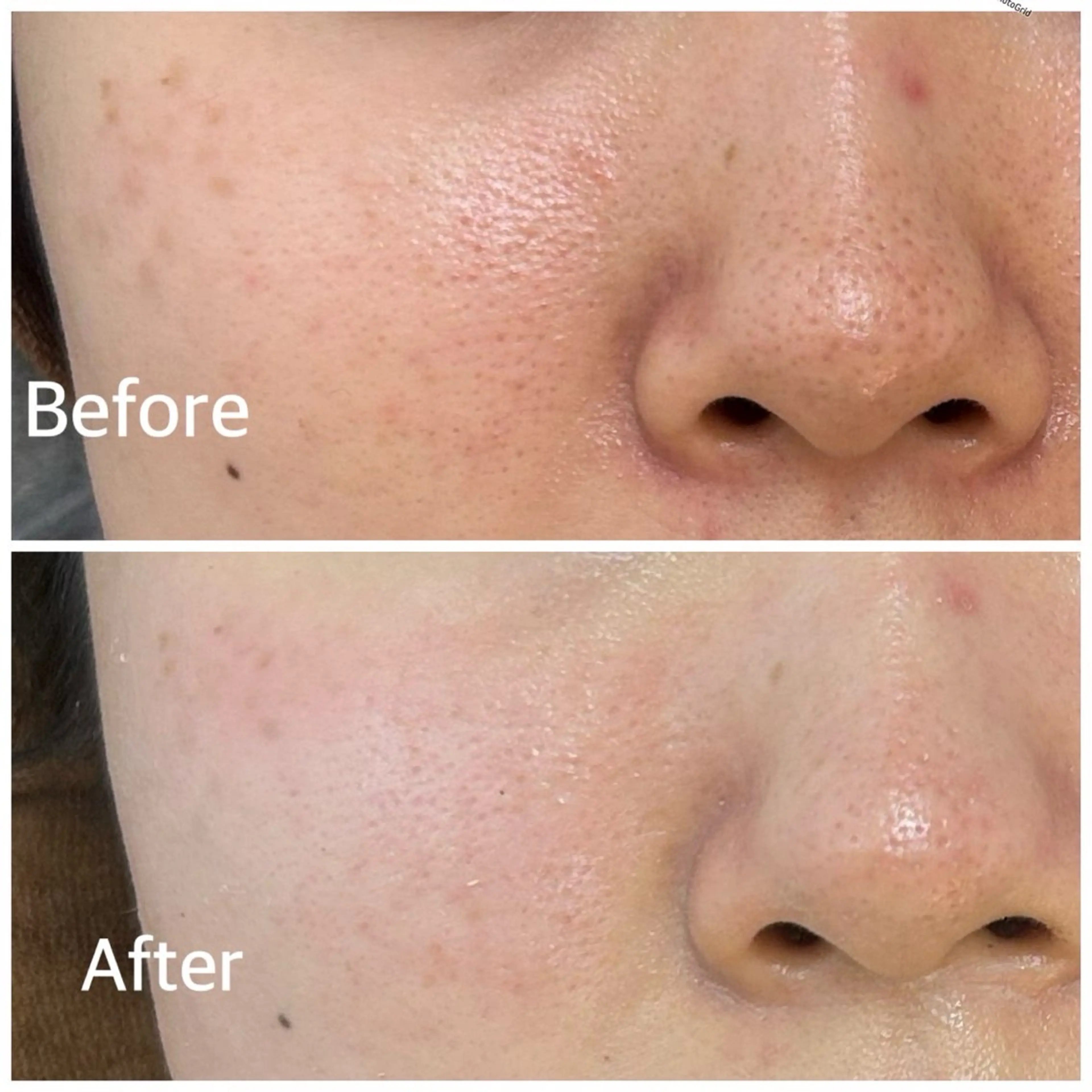 ホワイトニング・ハーブピーリング・フェイシャルサロンSUN所属・SUN MIWAのエステ・リラクイメージ