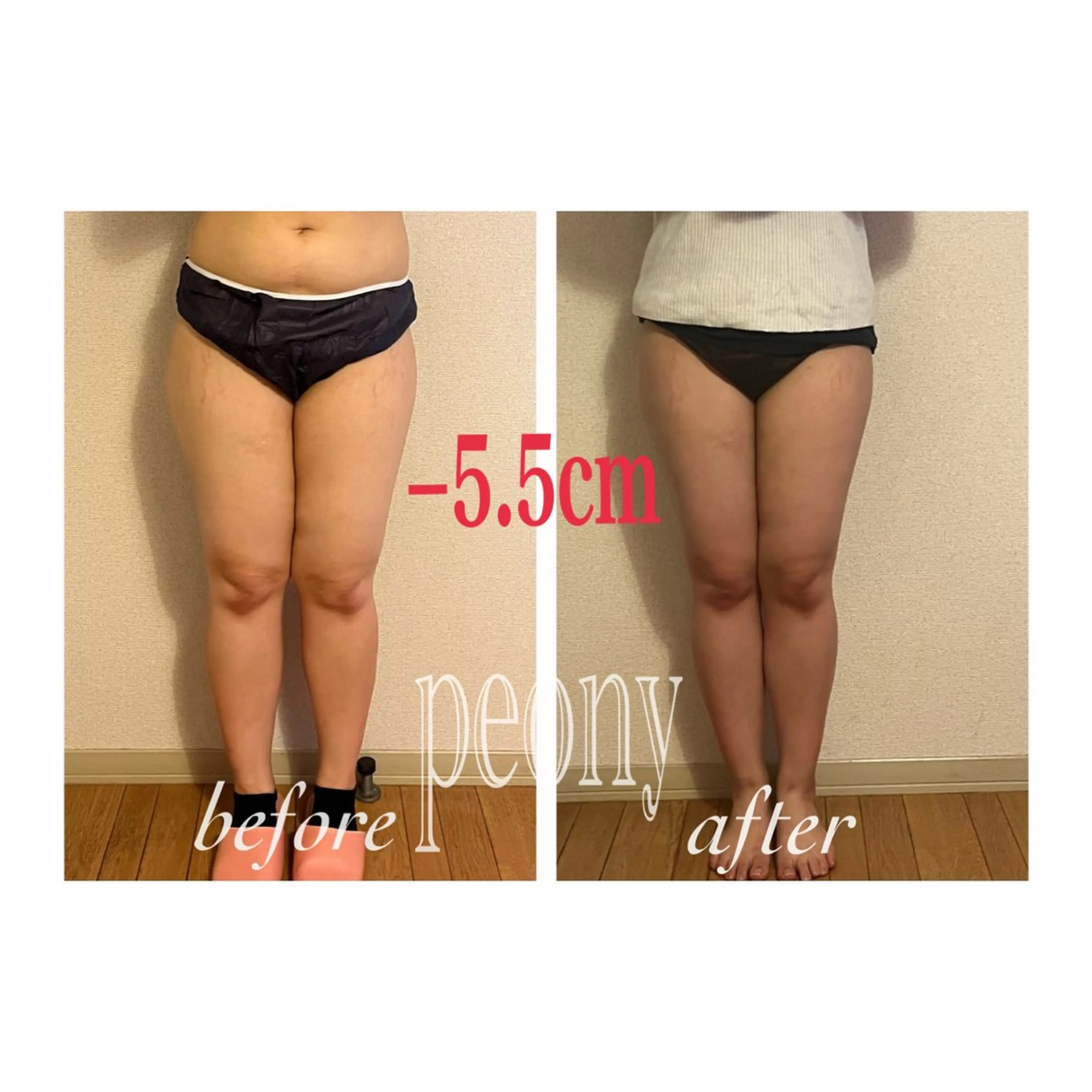 デトックス美容専門 サロンｐｅｏｎｙのエステ・リラクイメージ