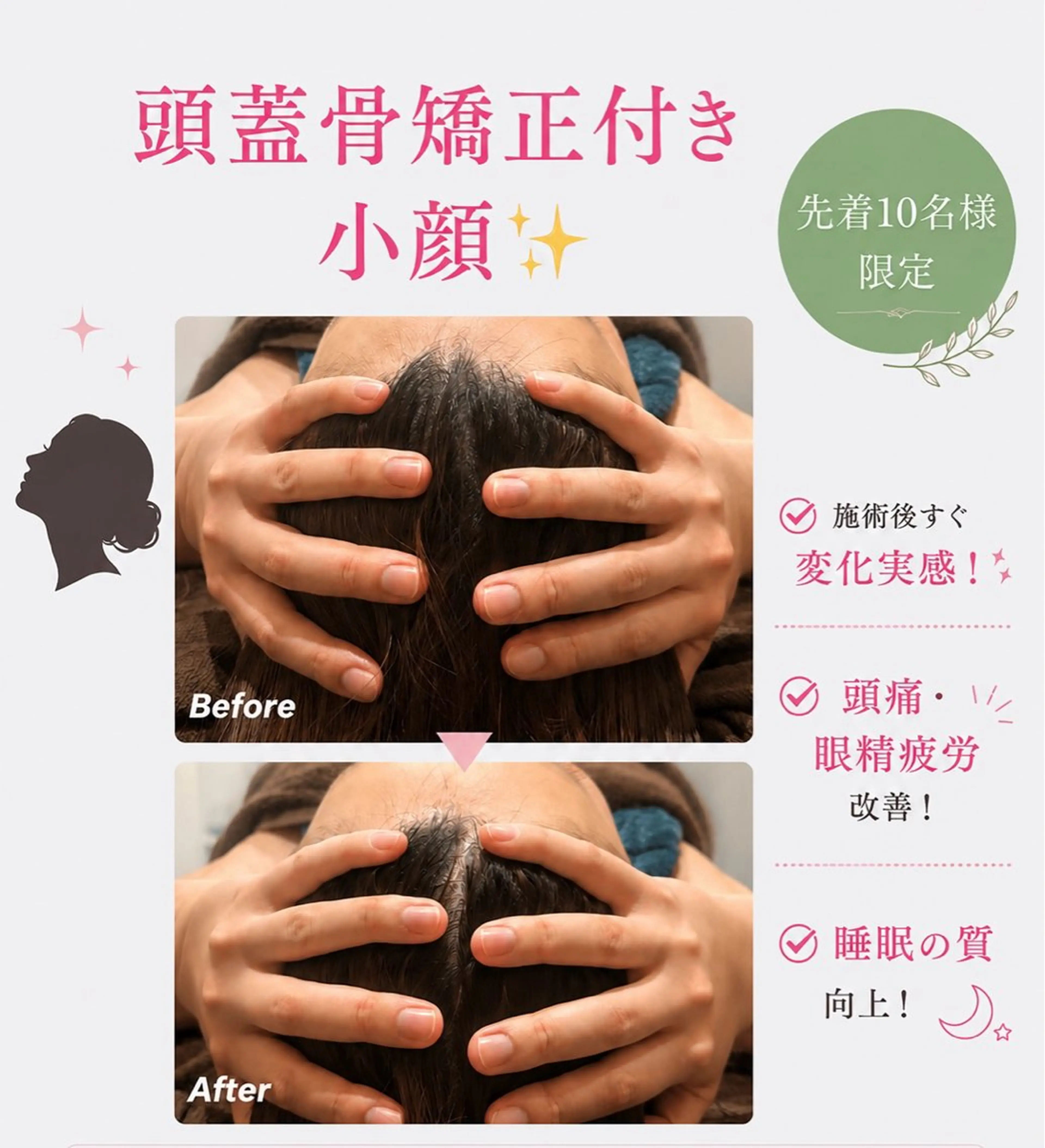 先着5名様限定【5月限定】3step小顔＋頭蓋骨矯正付き（100min）¥24,200→¥4,950の写真