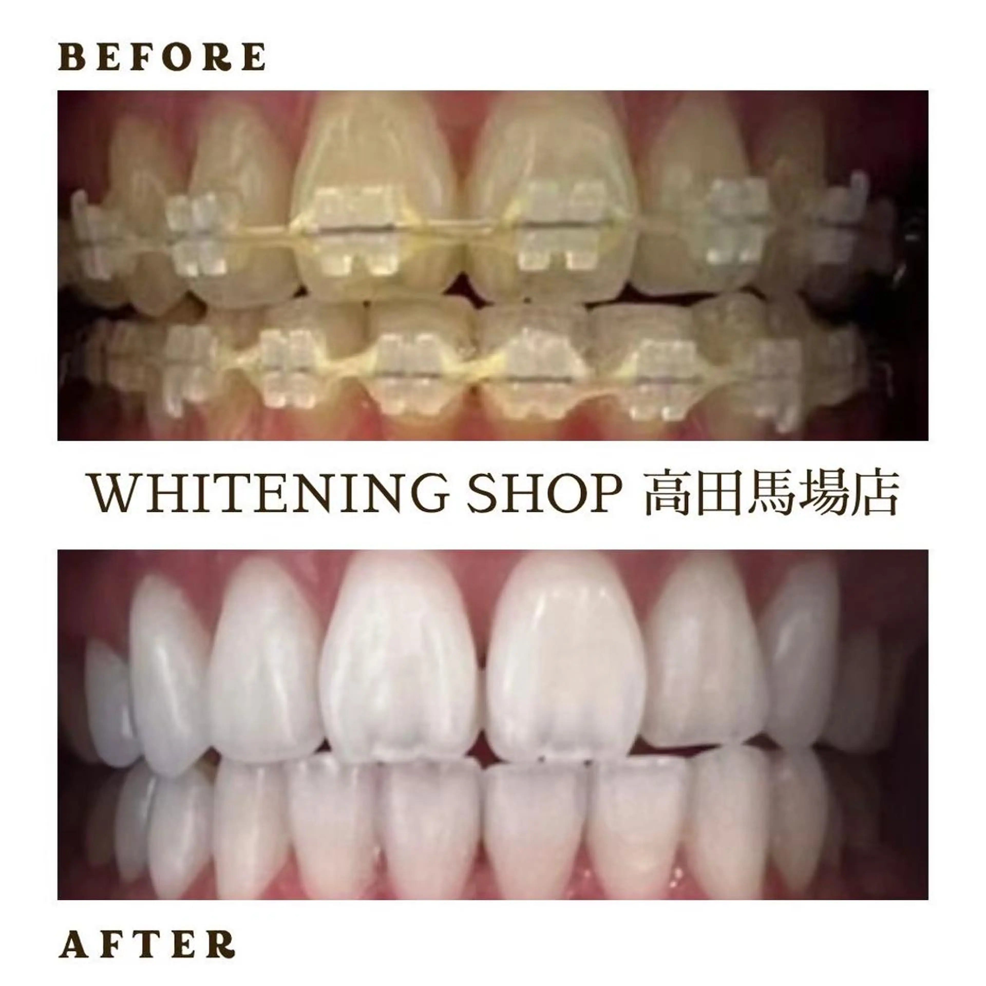メンズ その他 ホワイトニング ショップ高田馬場店のその他イメージ