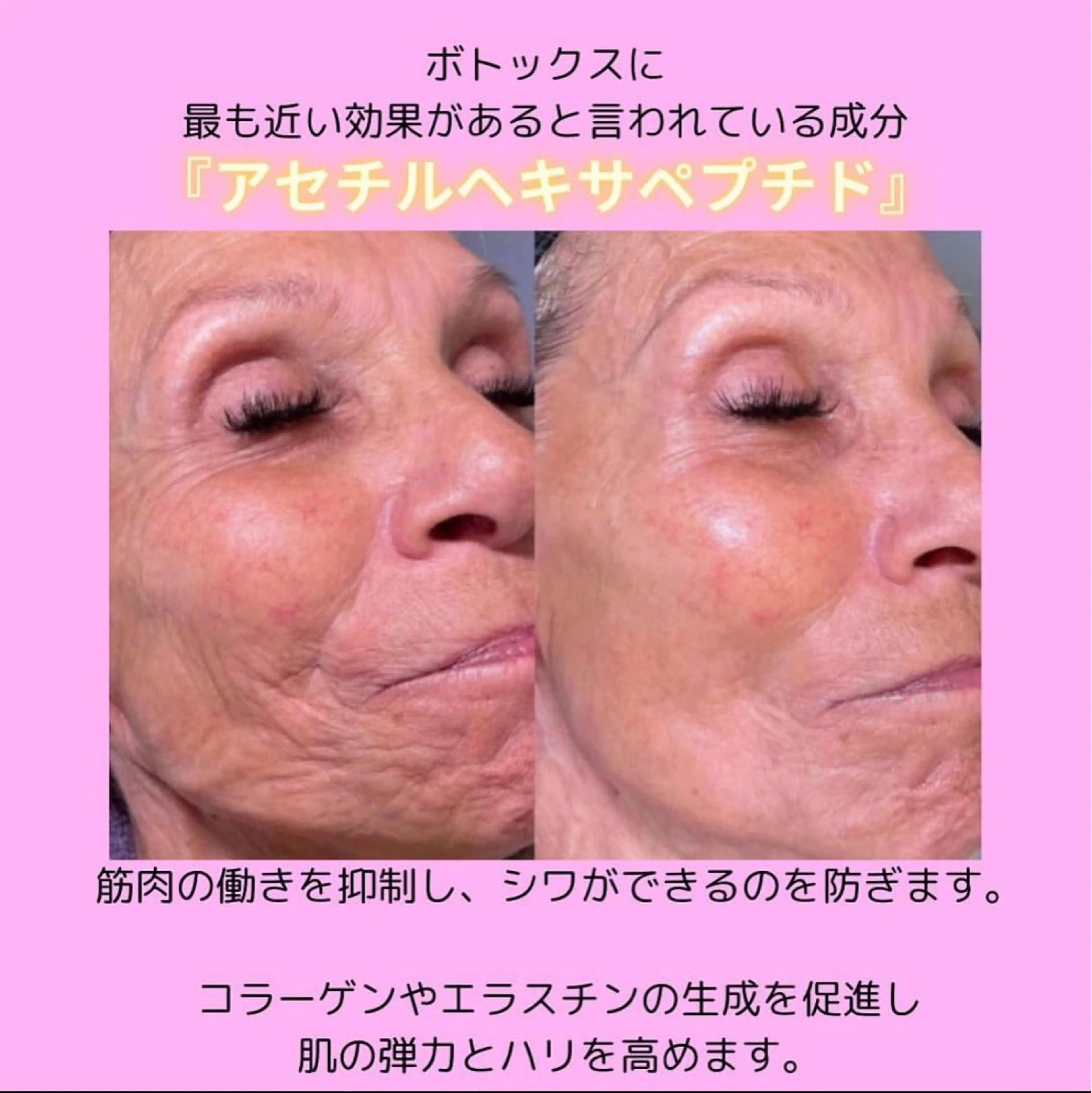 Lily luce 美骨小顔矯正のその他イメージ