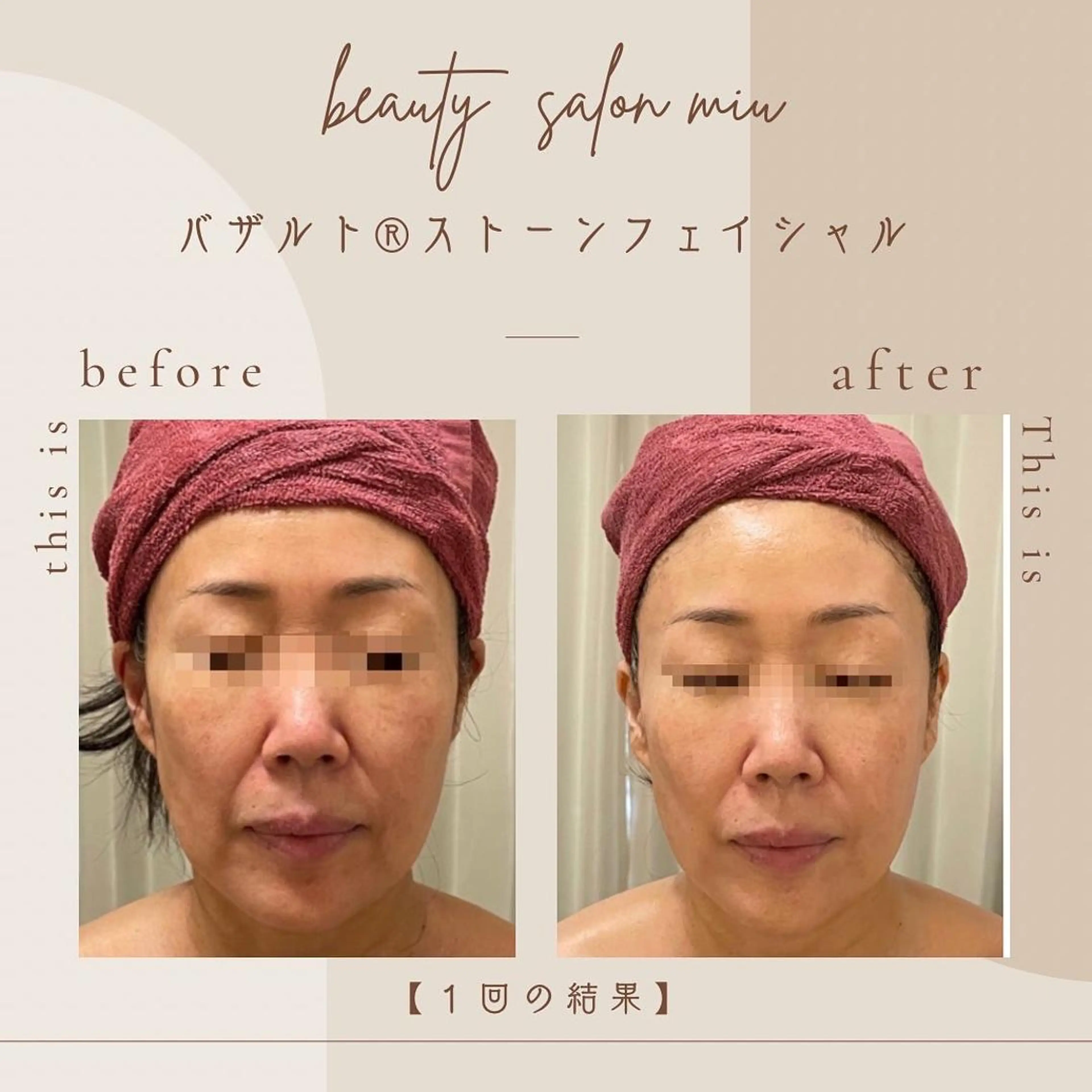 35歳からの エイジングケアサロンのエステ・リラクイメージ