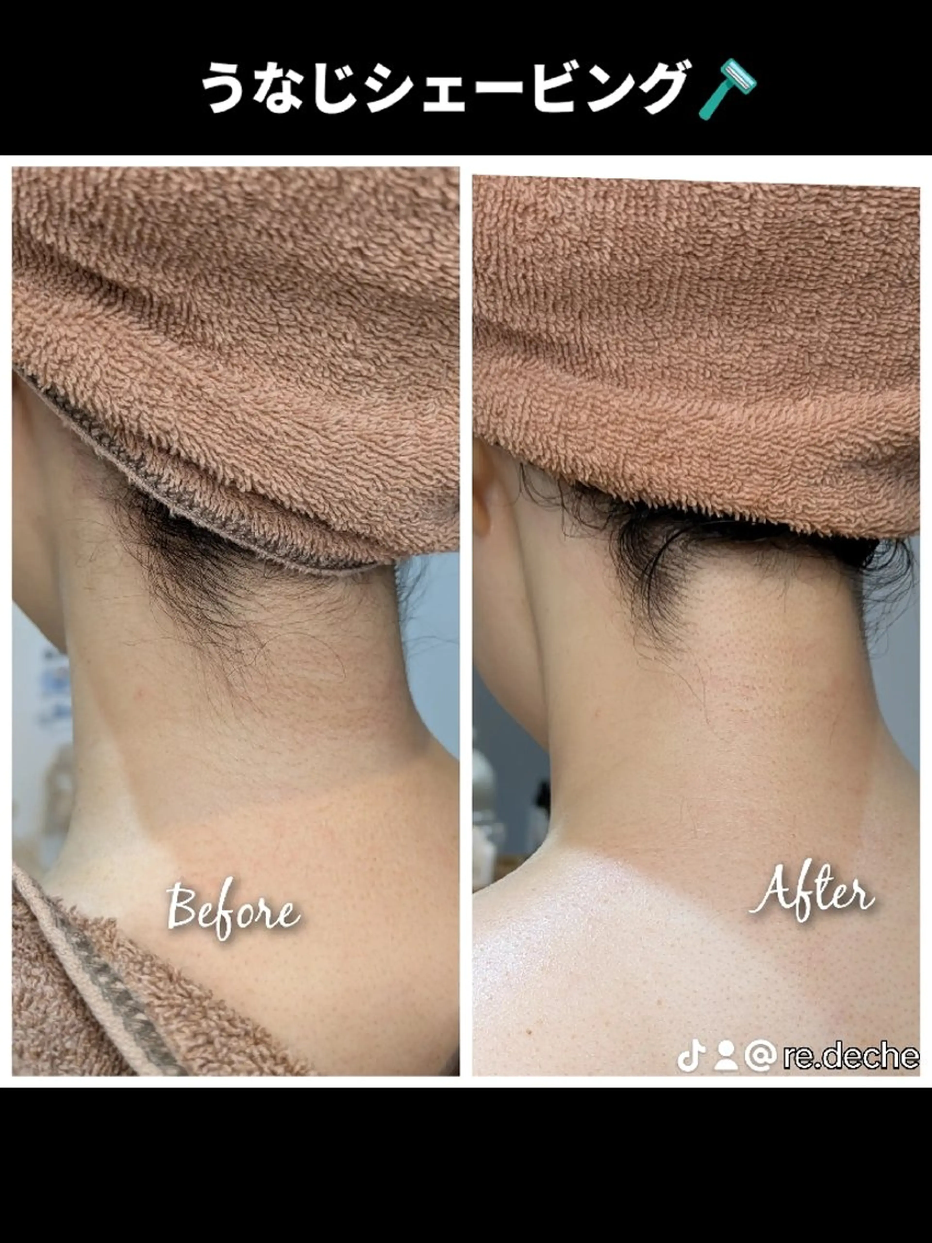 🟡レディース シェービングサロン/のエステ・リラクイメージ