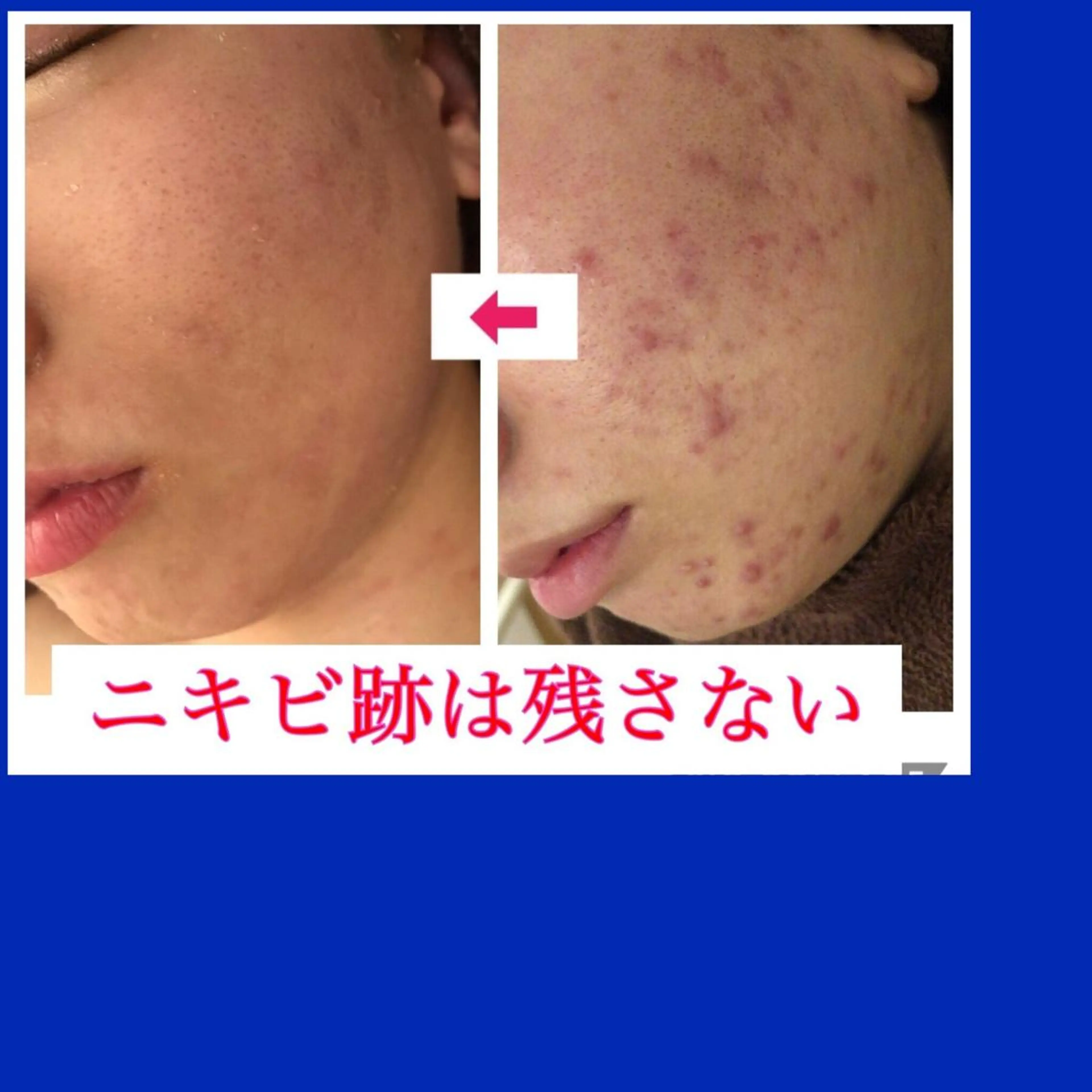 ミディアム カラー パーマ ヘアアレンジ メンズ キッズ ネイル マツエク・マツパ 金の糸脱毛 産毛ケア専門のエステ・リラクイメージ