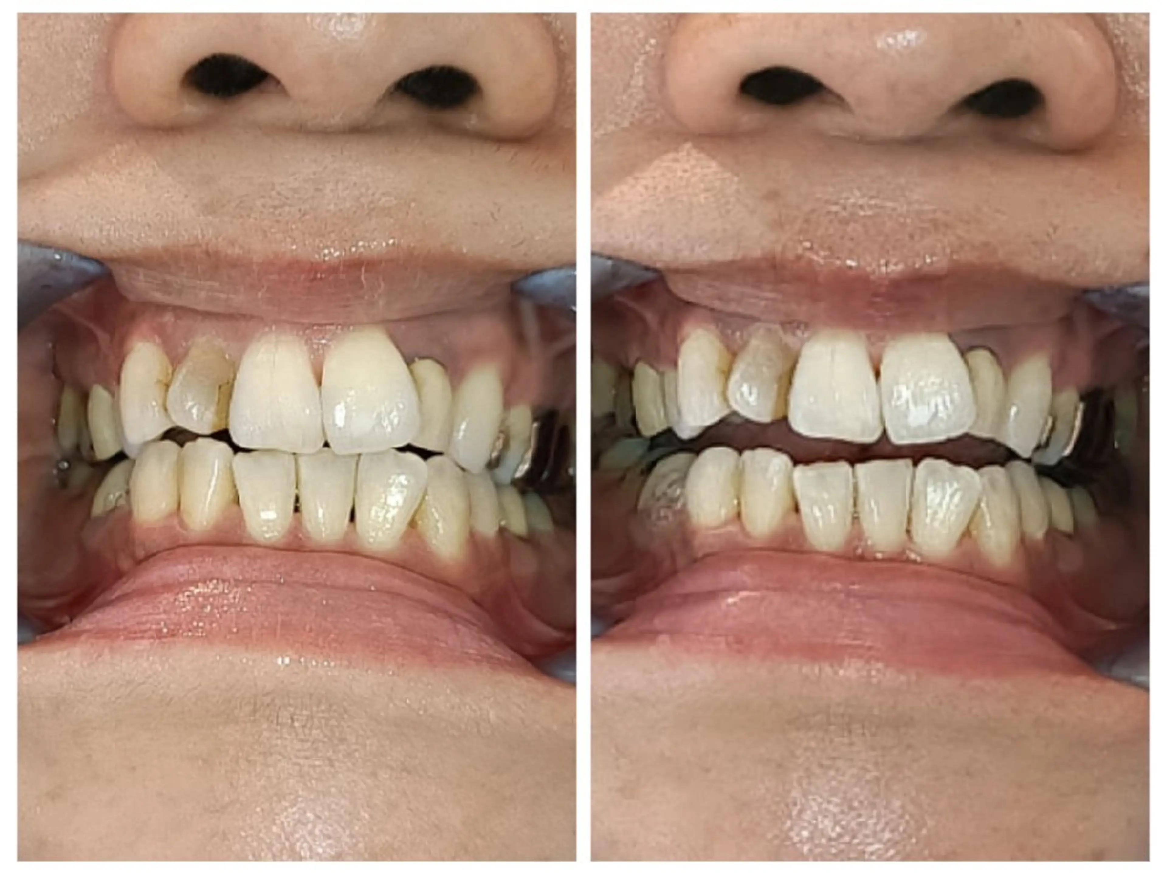 エステ A-family  kaoriのエステ・リラクイメージ