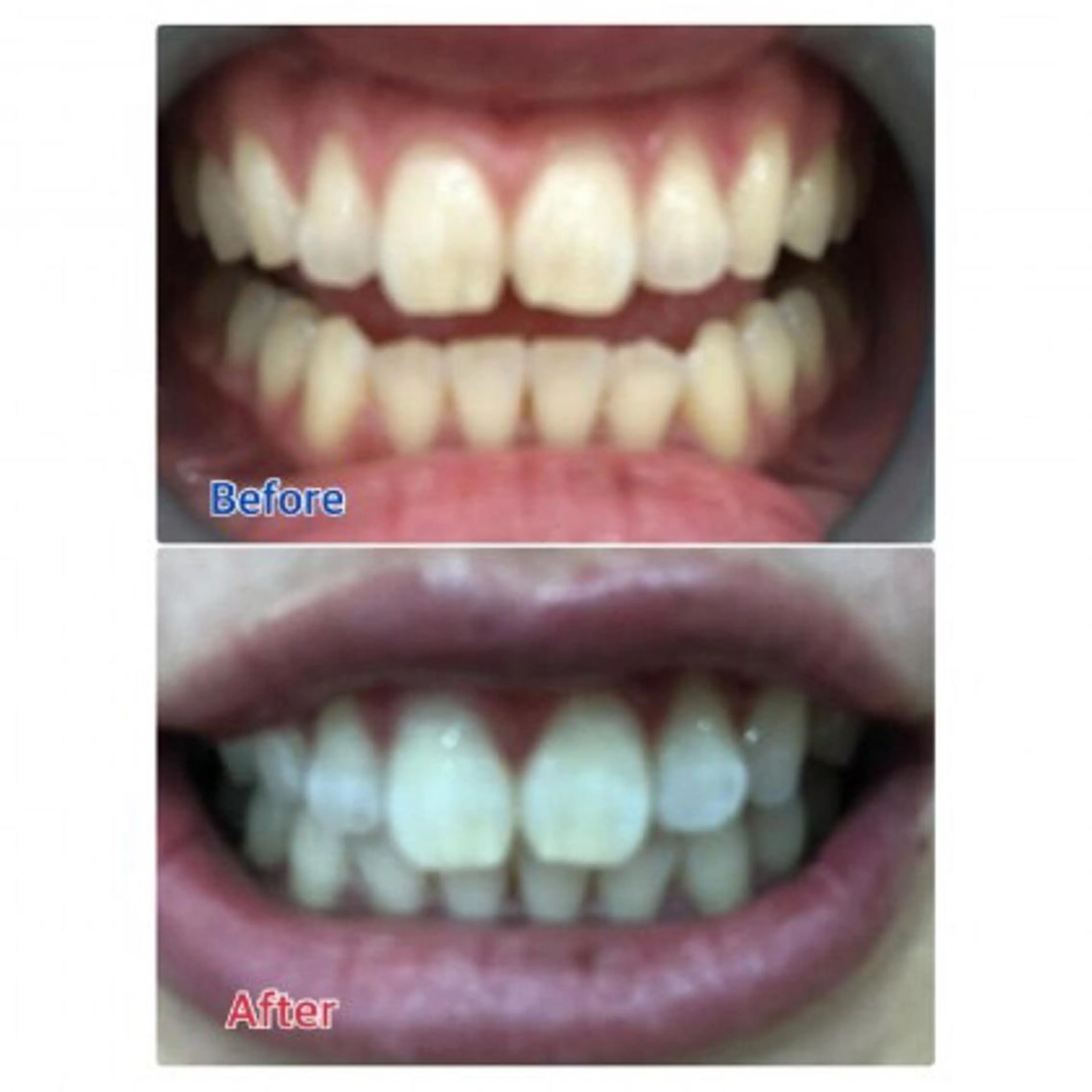 Ｍ渋谷 ホワイトニングのエステ・リラクイメージ