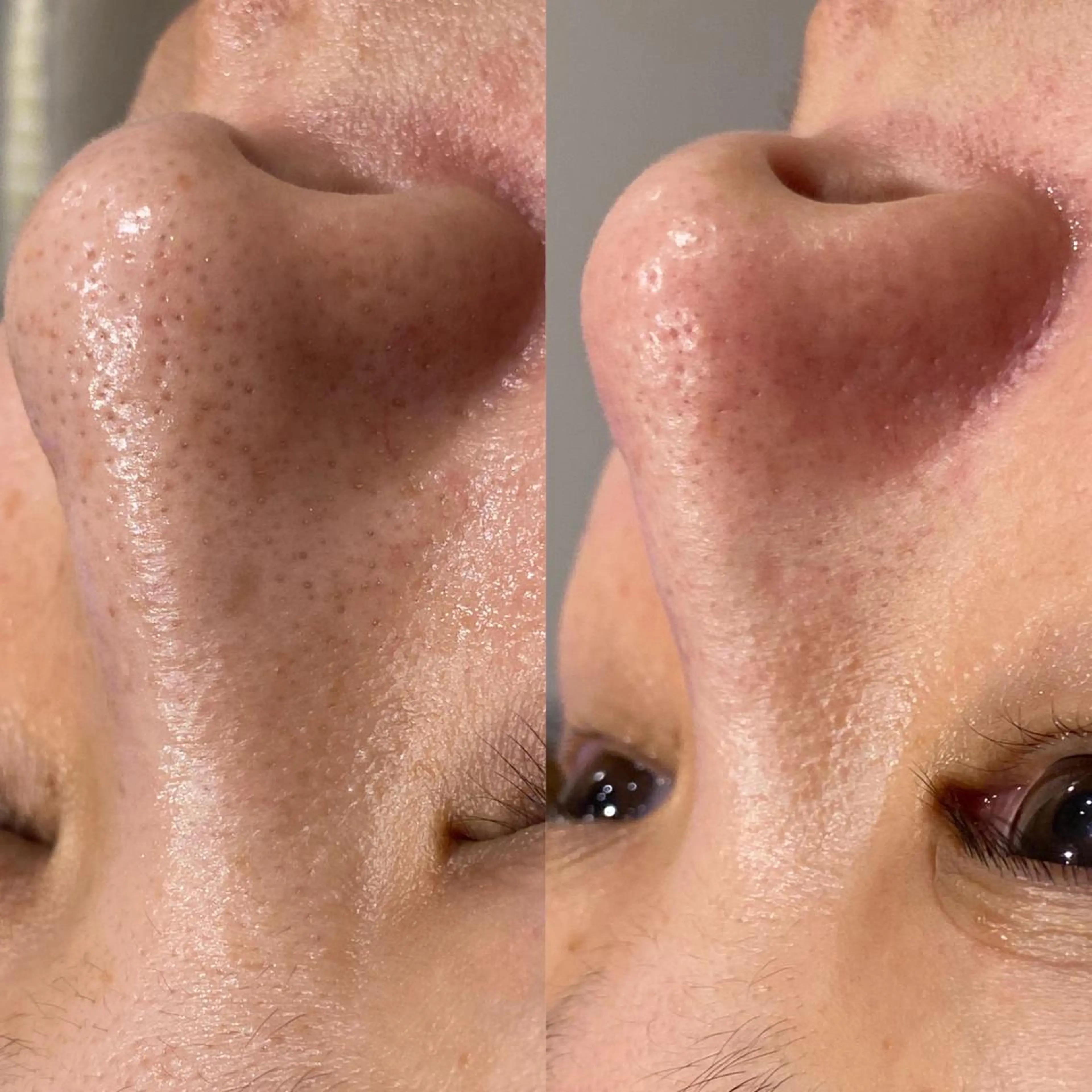 エステ Sii センター北のエステ・リラクイメージ