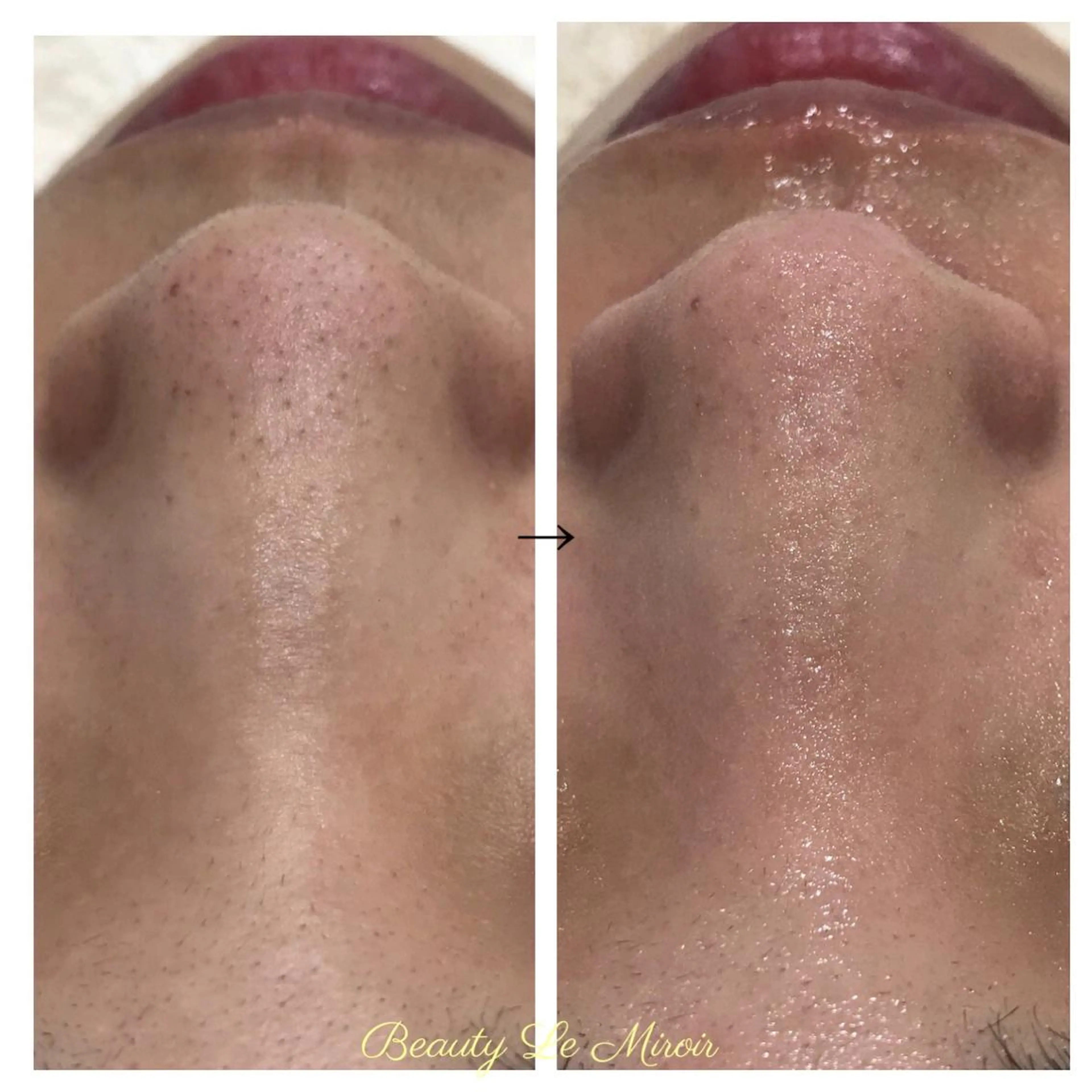 ビューティー ミロワールのエステ・リラクイメージ