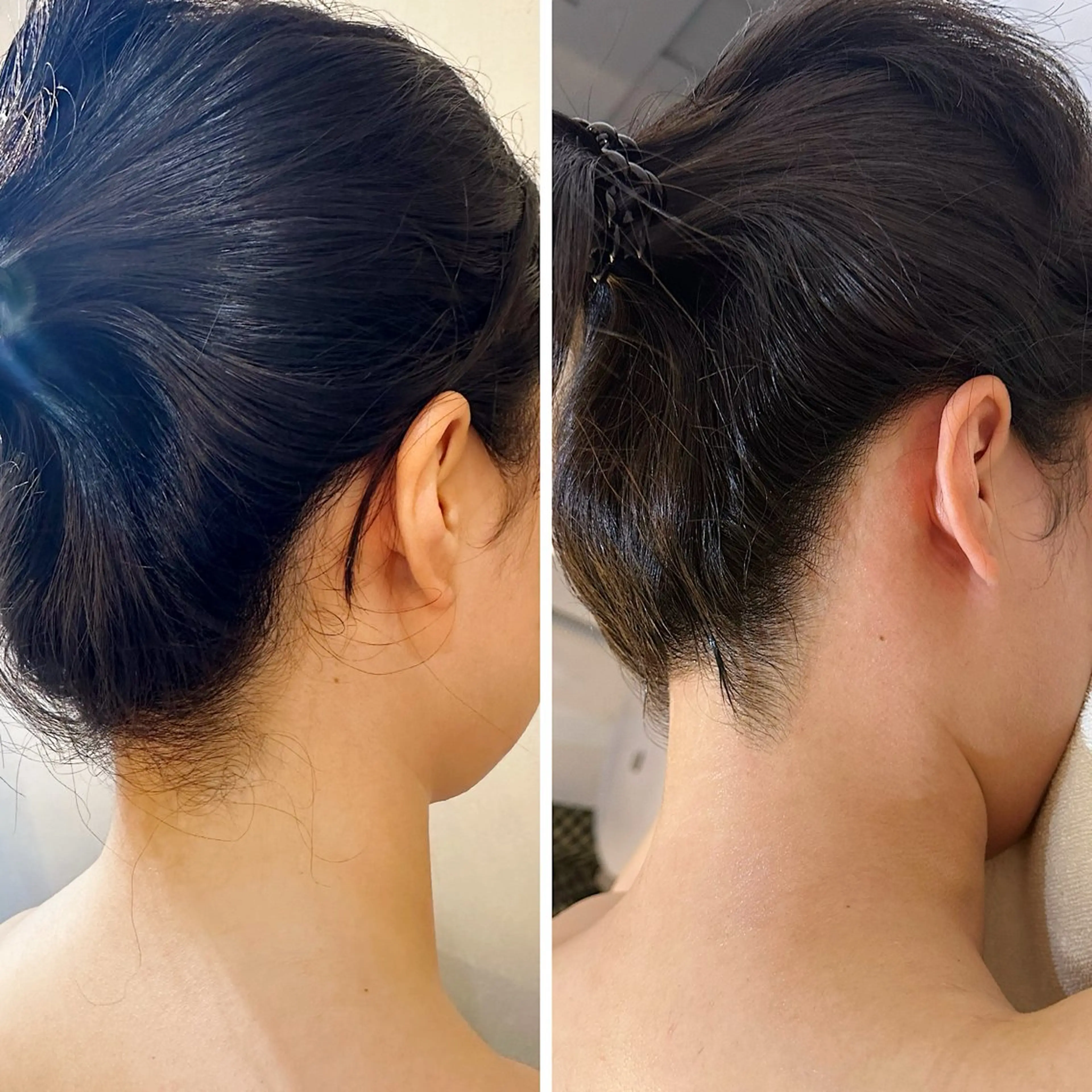 脱毛 うなじ脱毛/美肌脱毛 LABELのエステ・リラクイメージ