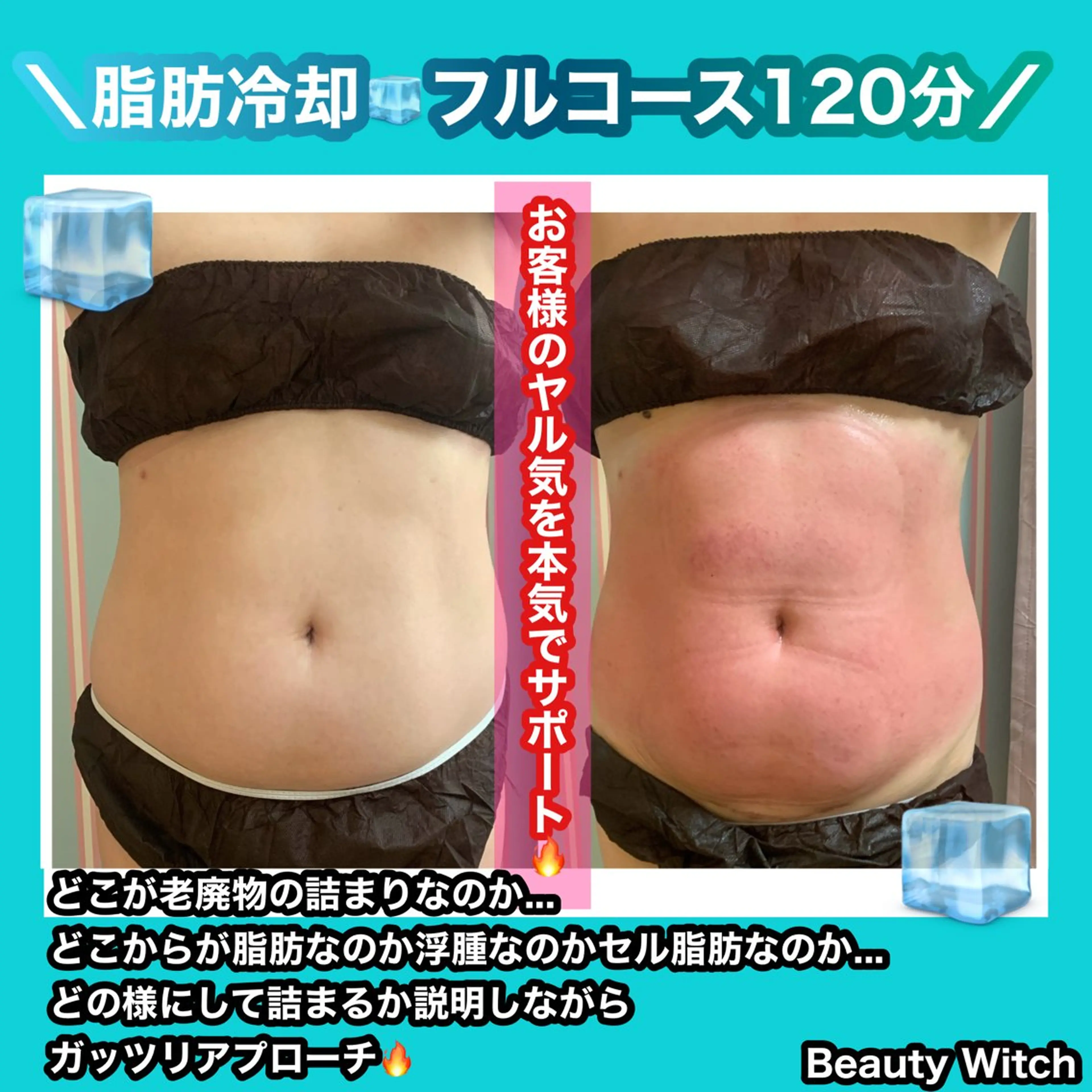 エステ 痩身/脱毛/ネイル HARUKAのエステ・リラクイメージ