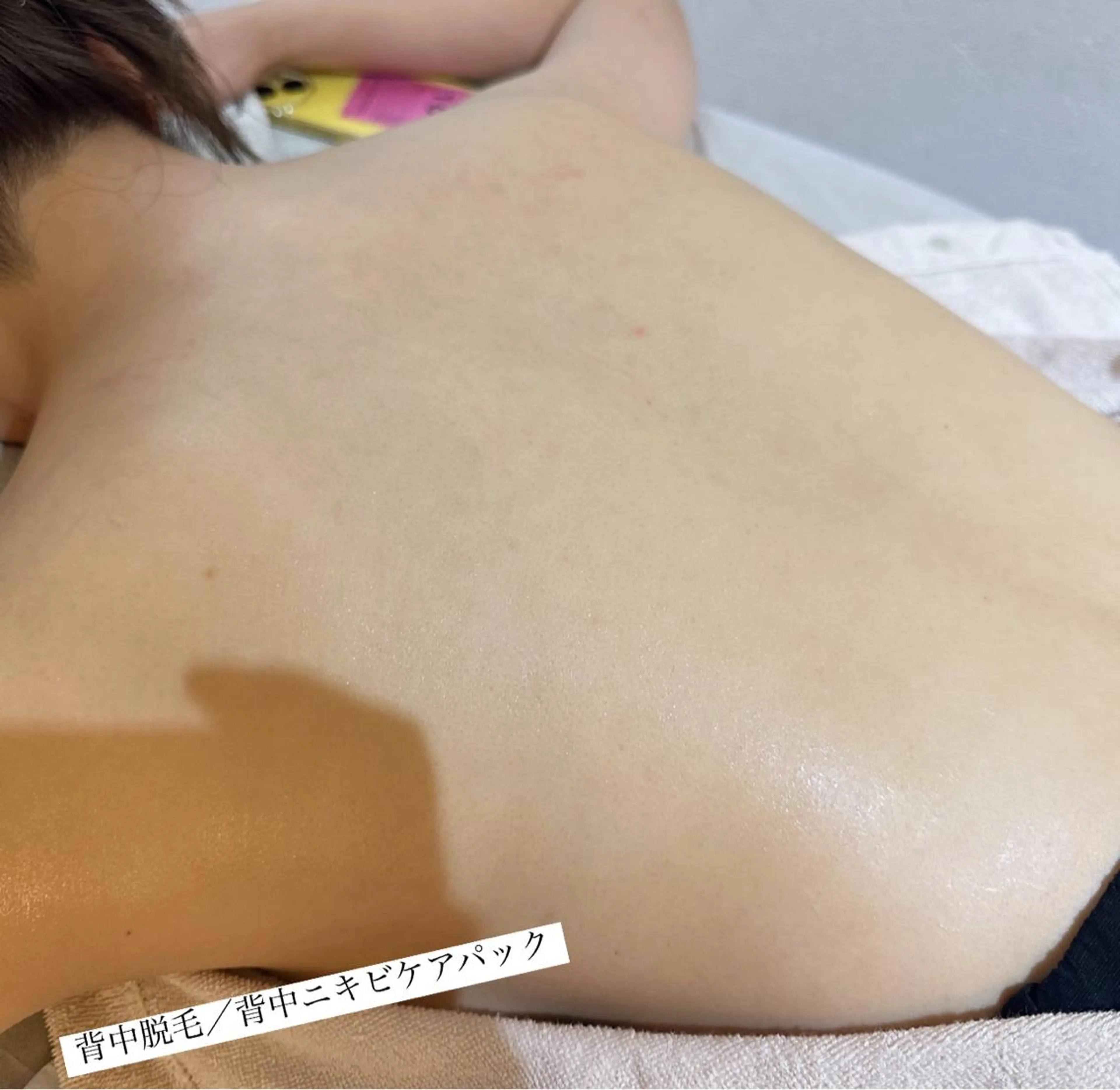 うなじ脱毛/美肌脱毛 LABELのエステ・リラクイメージ