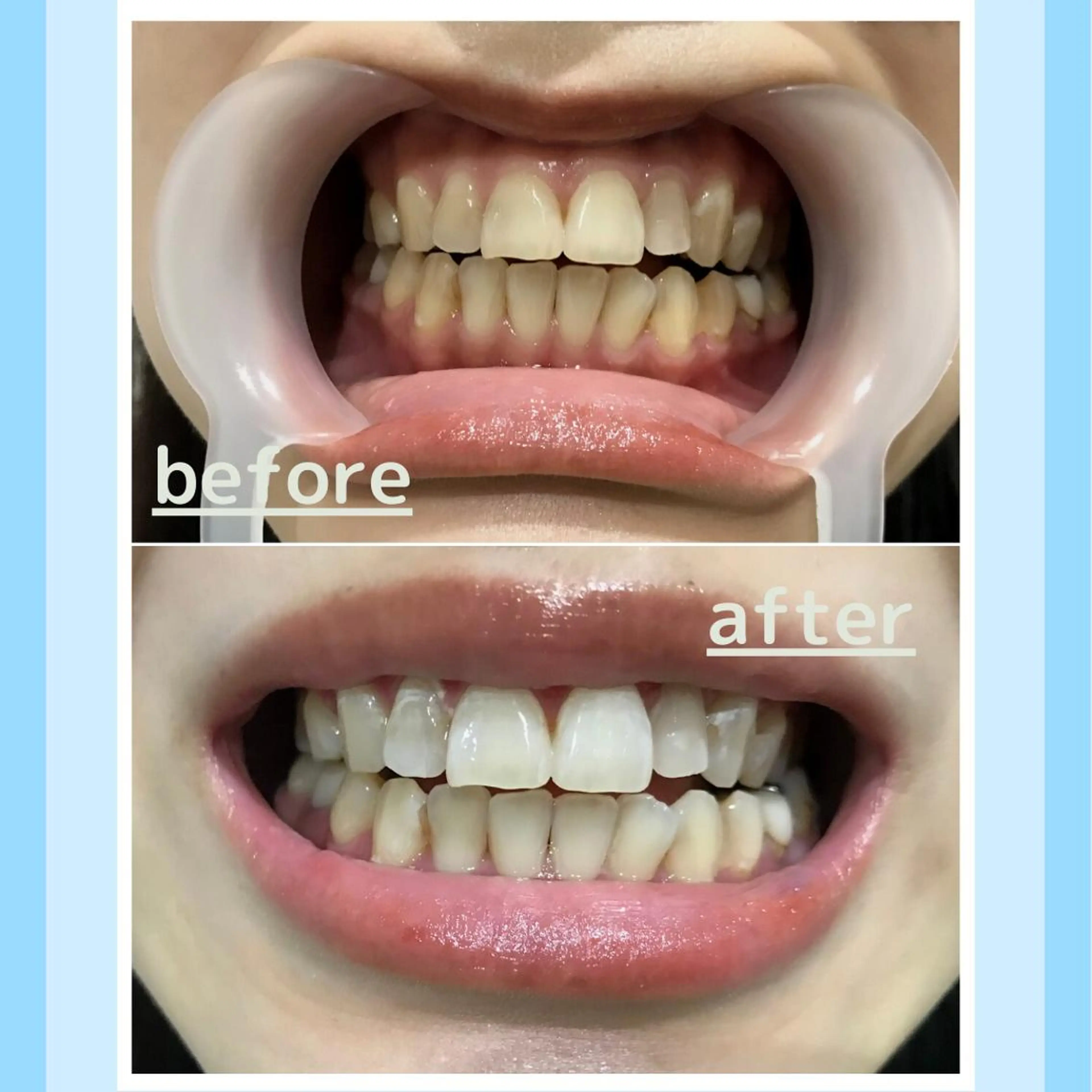 メンズ お手軽ホワイトニングsalon mina所属・武元 奈津美のその他イメージ