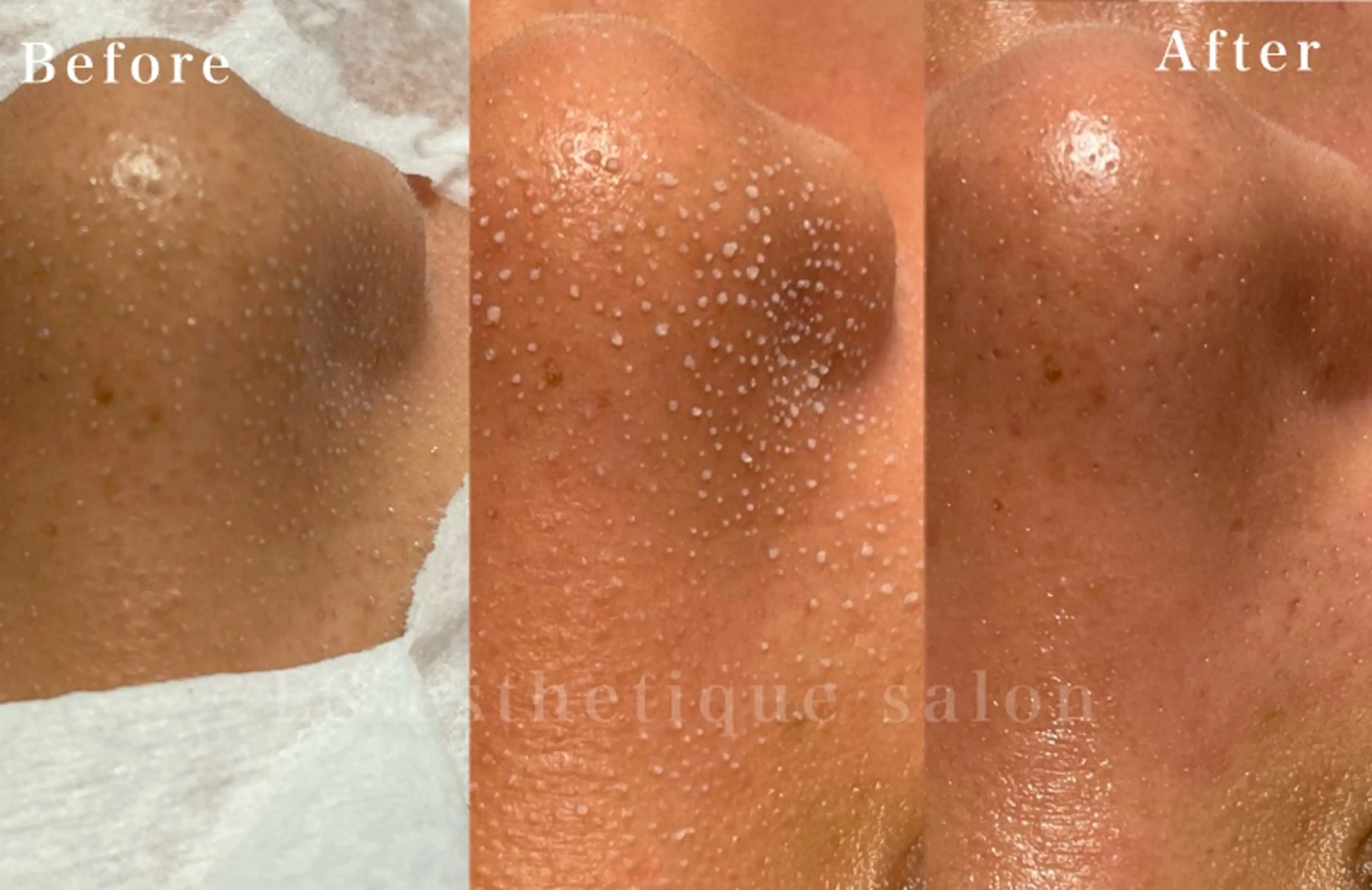 エステ Mano Amikaのエステ・リラクイメージ