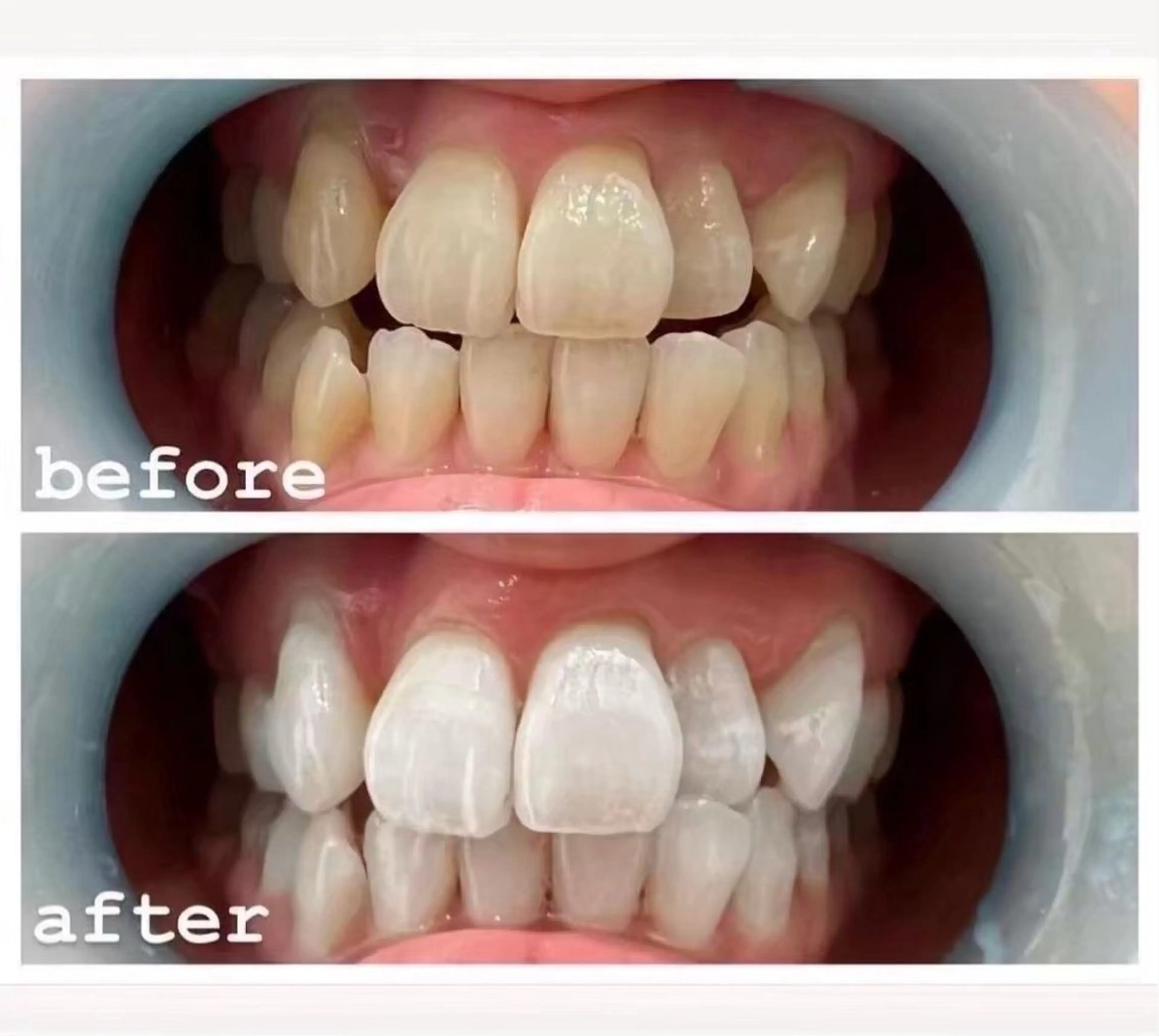 その他 ルミナホワイト 店長 もえかのその他イメージ