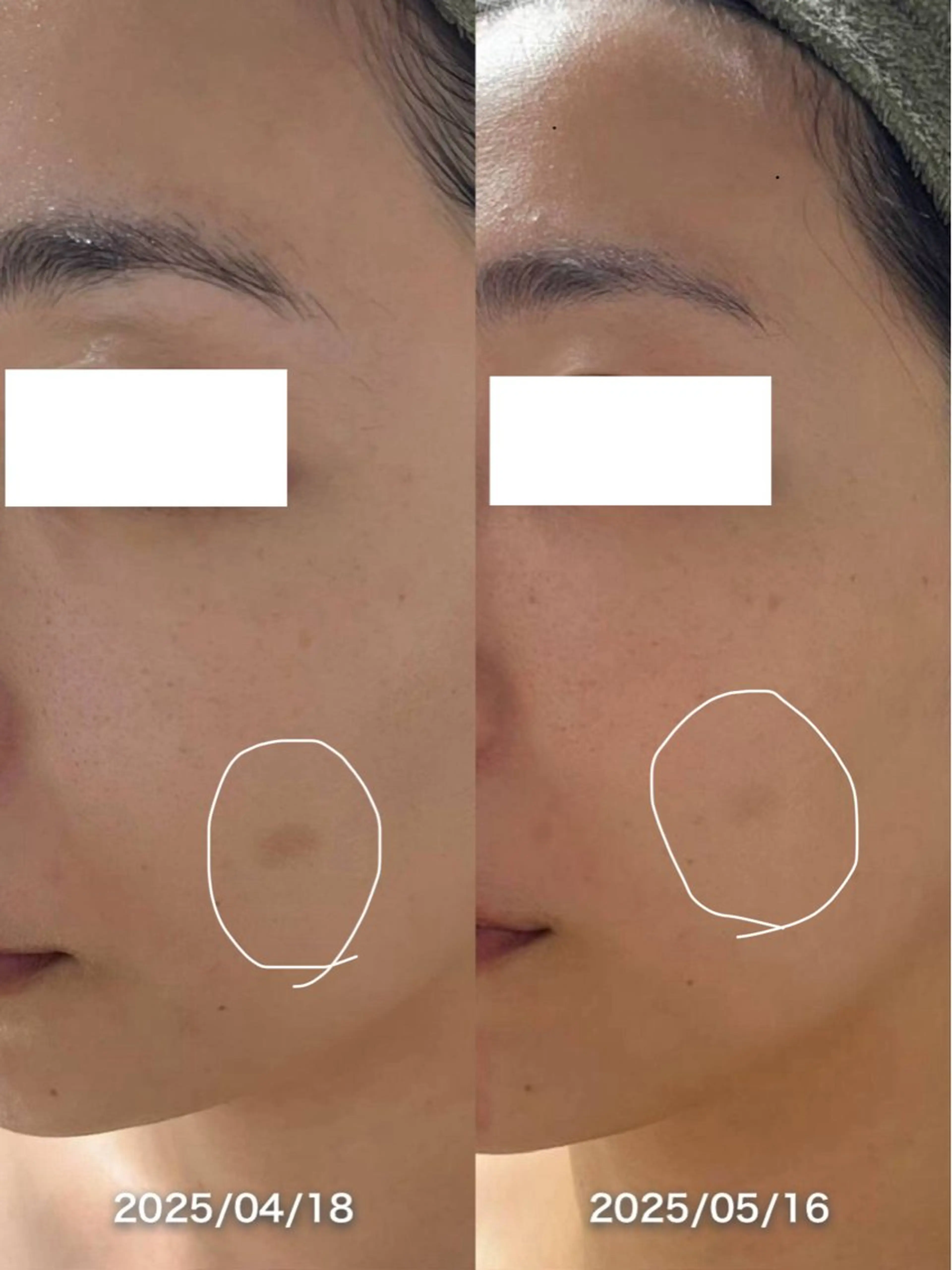 エステ 韓国美肌/肌質改善 【天神】のエステ・リラクイメージ