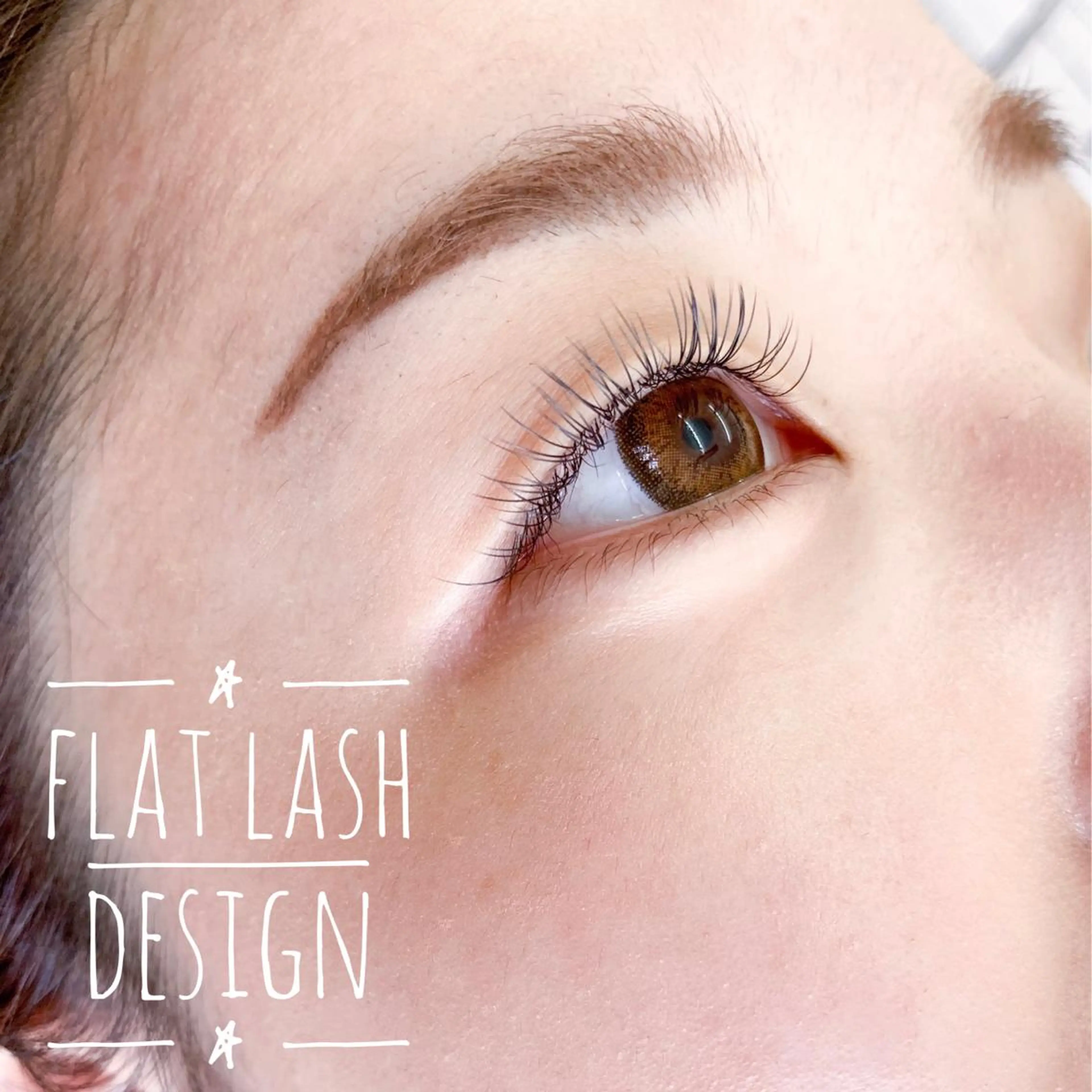 フラットラッシュ 140本の写真