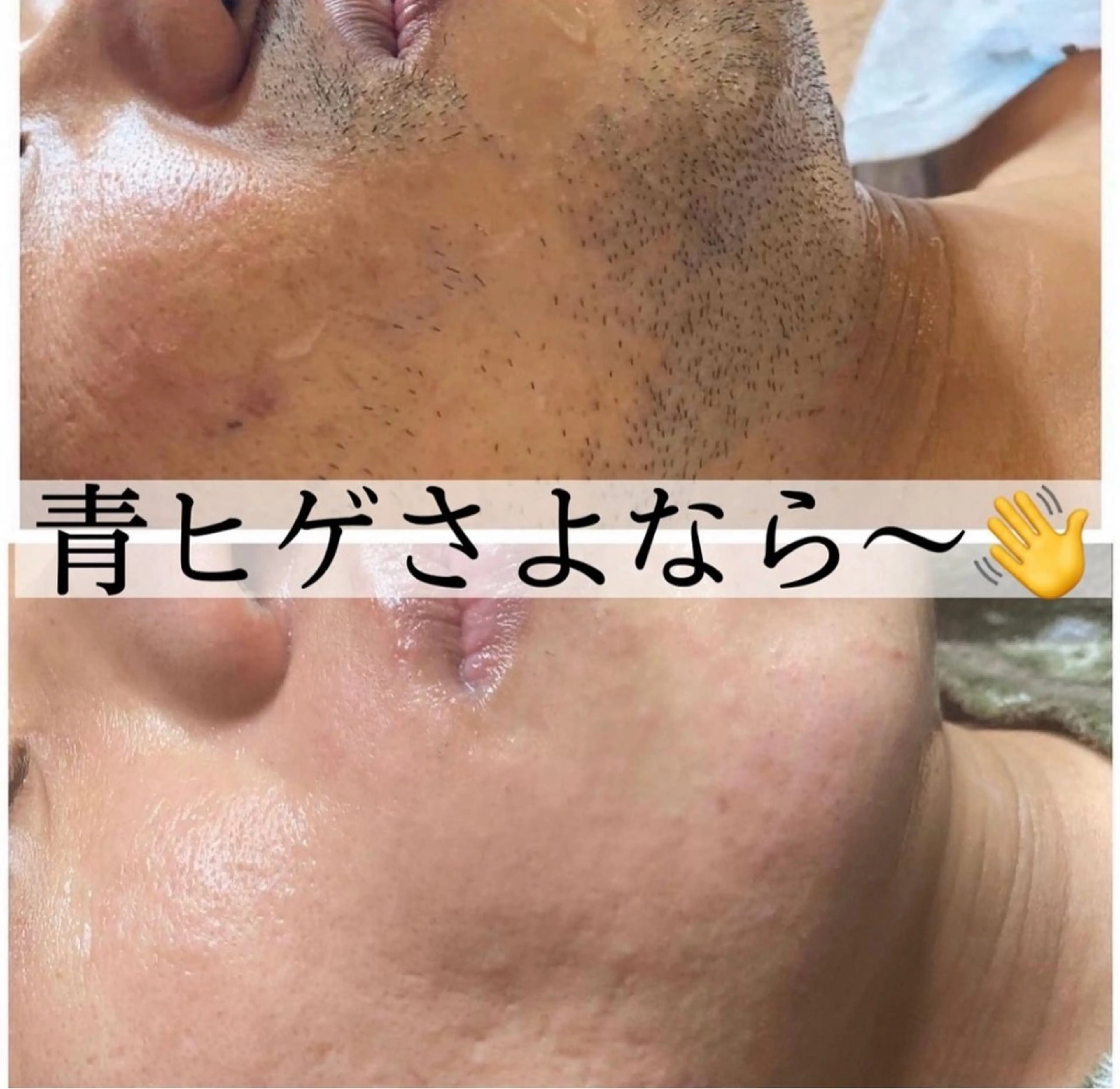 メンズ 脱毛 茶谷 梨紗のエステ・リラクイメージ