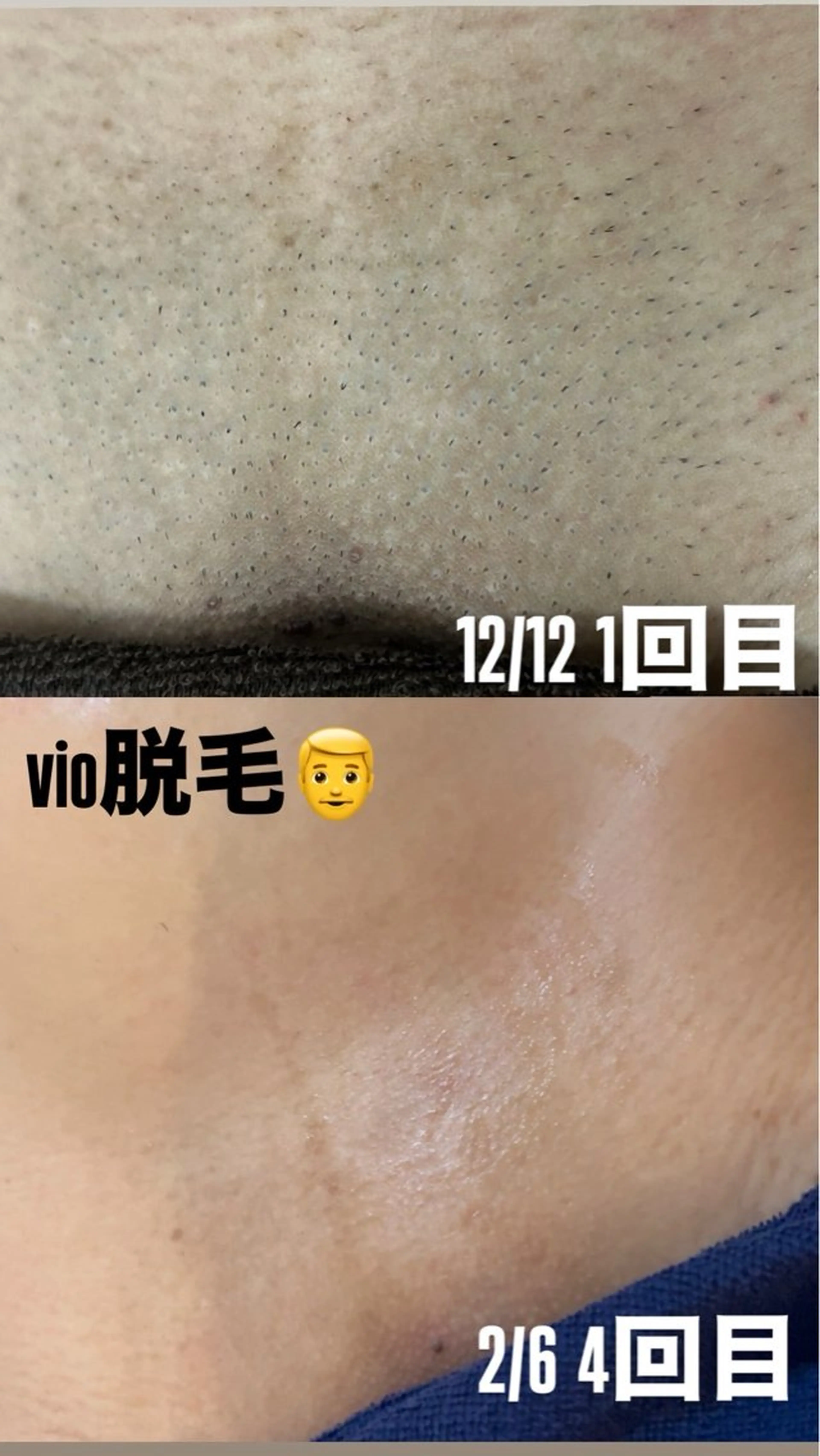 Firstclass Erikaのエステ・リラクイメージ