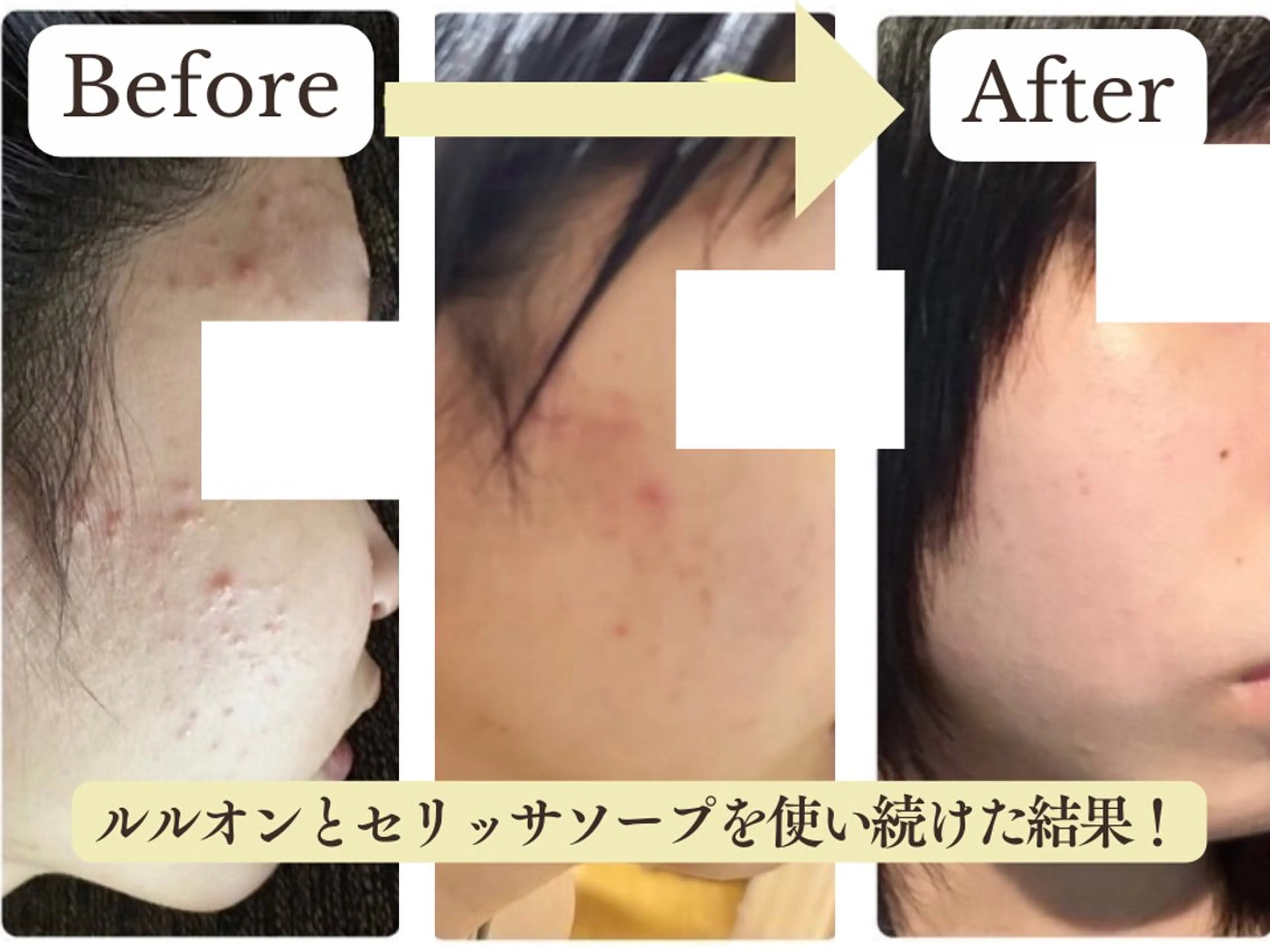 【目黒】本格痩身✴︎ 最新型よもぎ蒸しのエステ・リラクイメージ