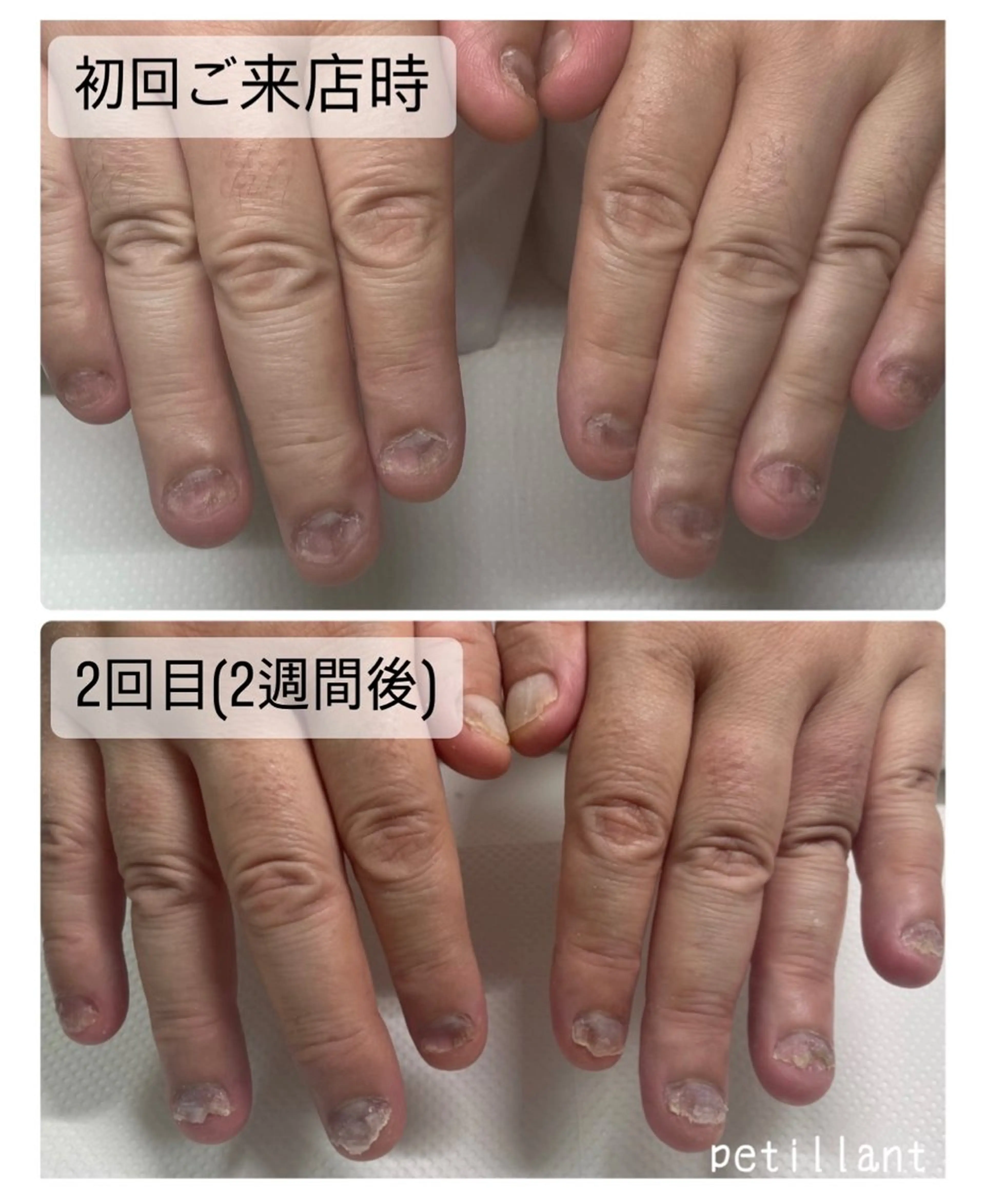 ネイル nail salon petillantのネイルデザイン