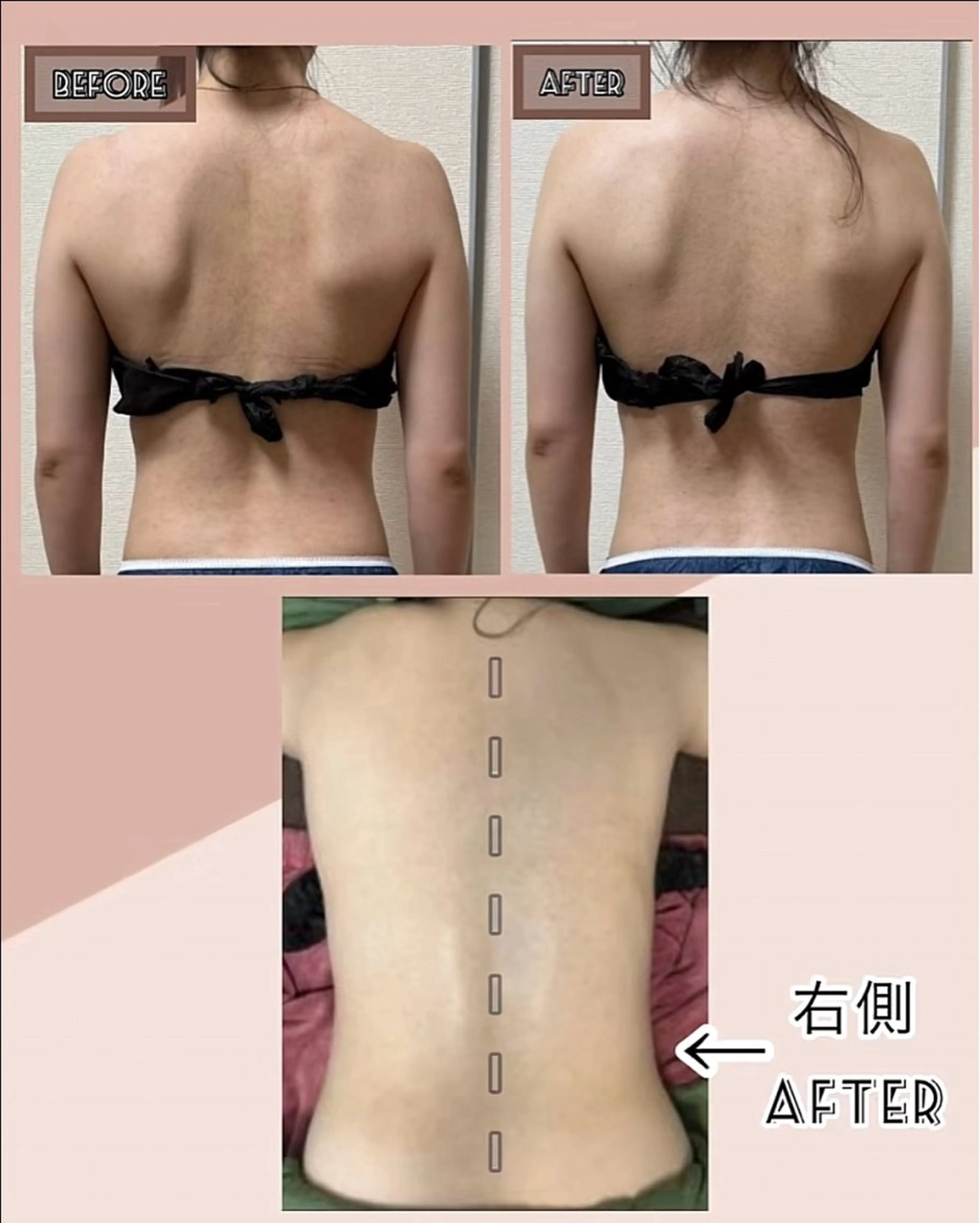 エステ ヴィーナス ビューティーのエステ・リラクイメージ