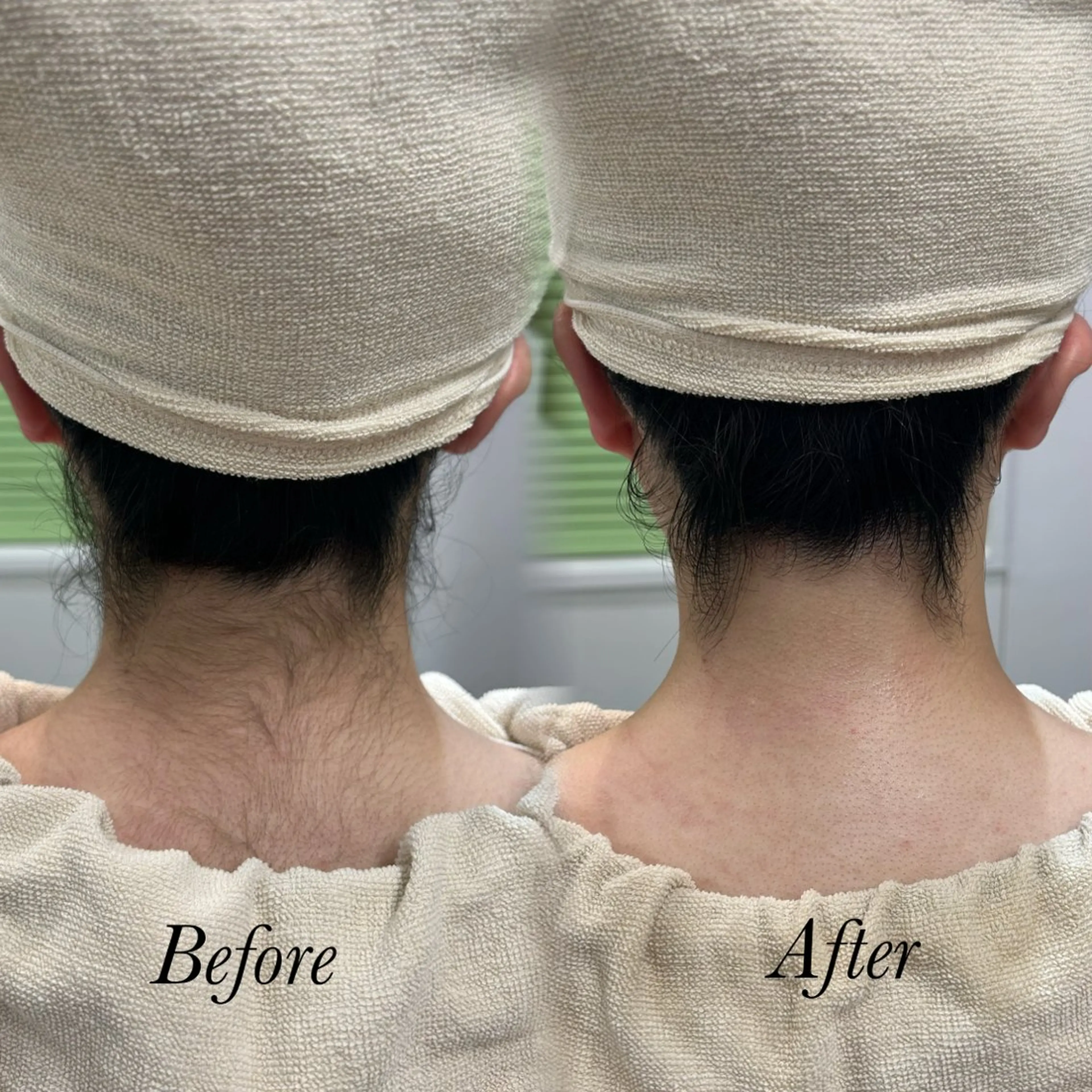 その他 🫧美しい素肌へ🫧 今成柚乃のその他イメージ