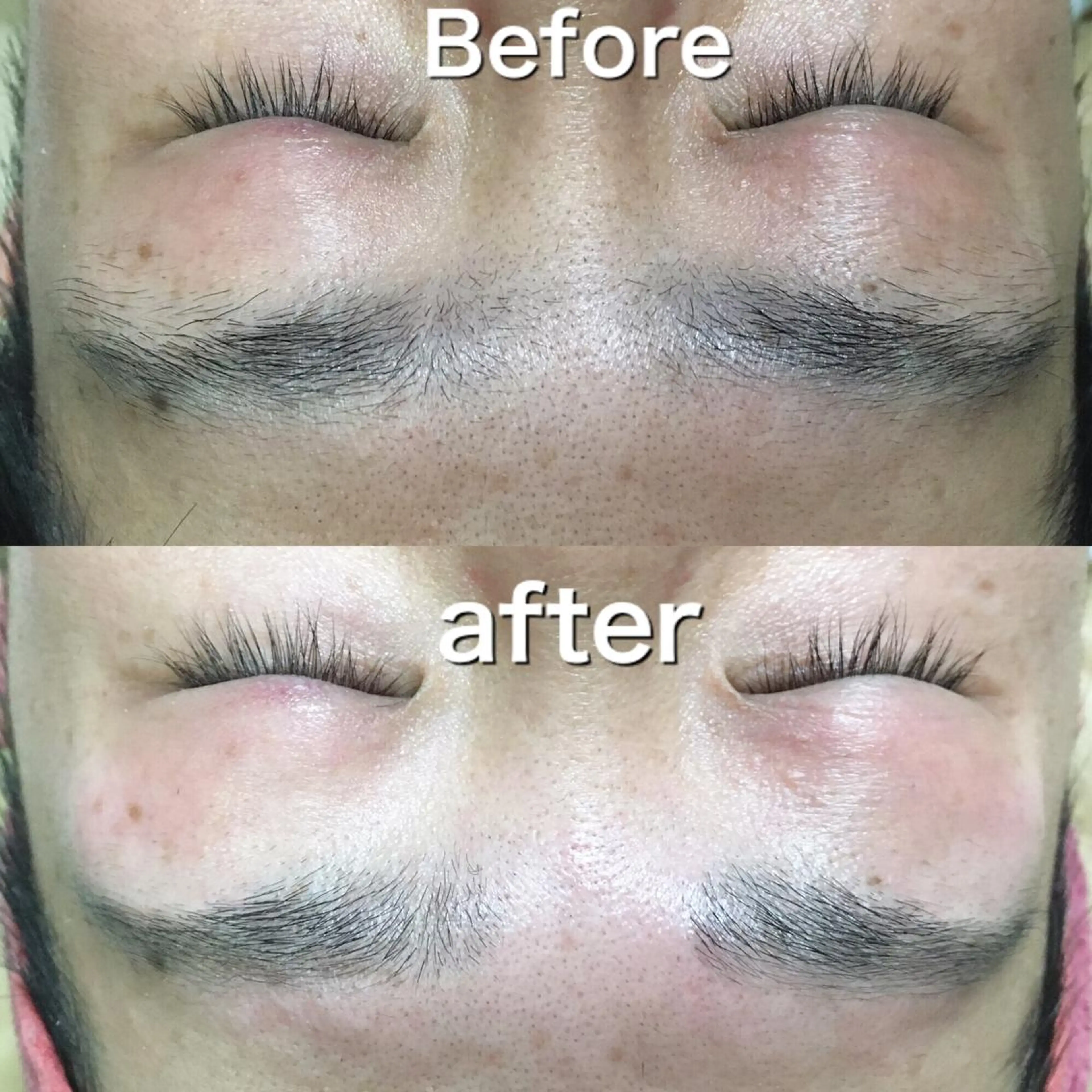 脱毛サロン KiWiのエステ・リラクイメージ