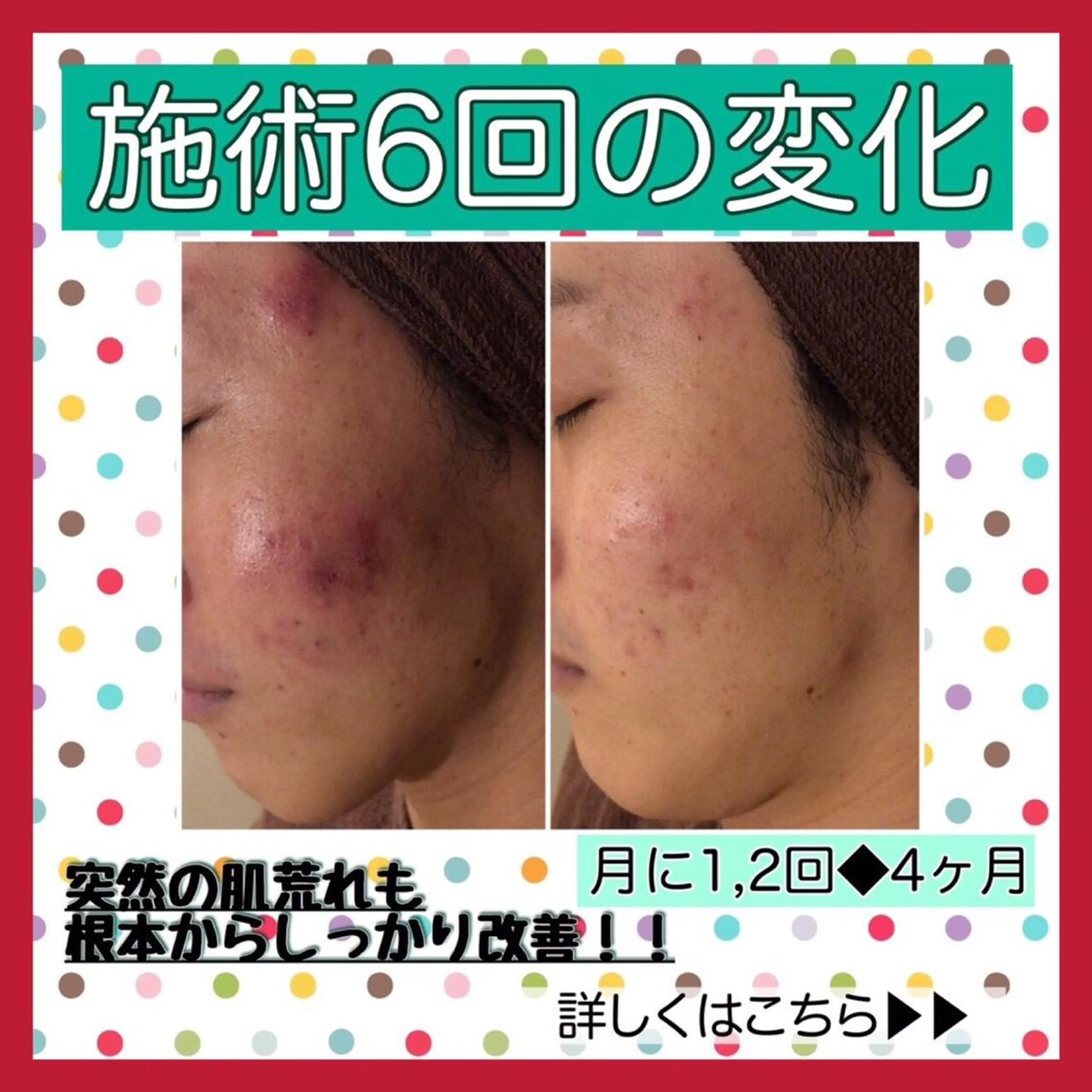 ミディアム カラー パーマ ヘアアレンジ メンズ キッズ ネイル マツエク・マツパ ニキビ・肌質改善専門 ♡人生が変わるサロンのエステ・リラクイメージ