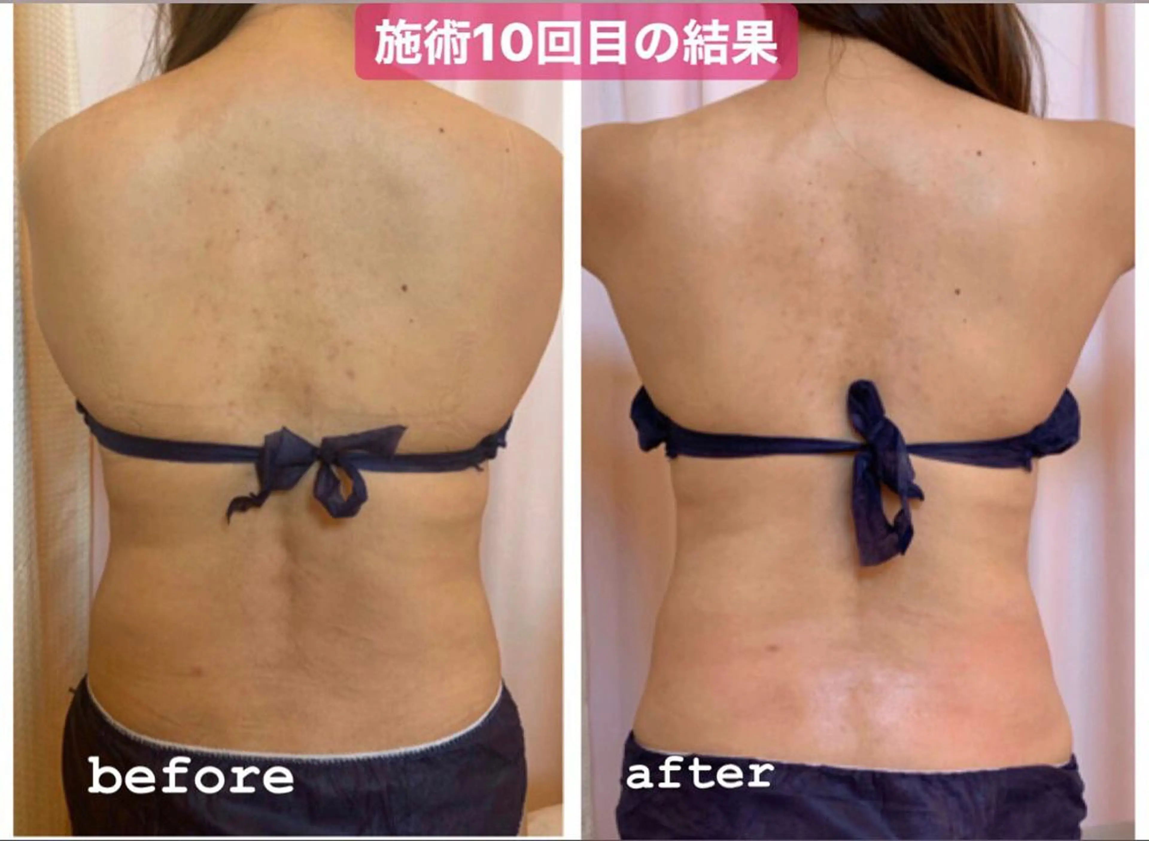 &. BYのエステ・リラクイメージ