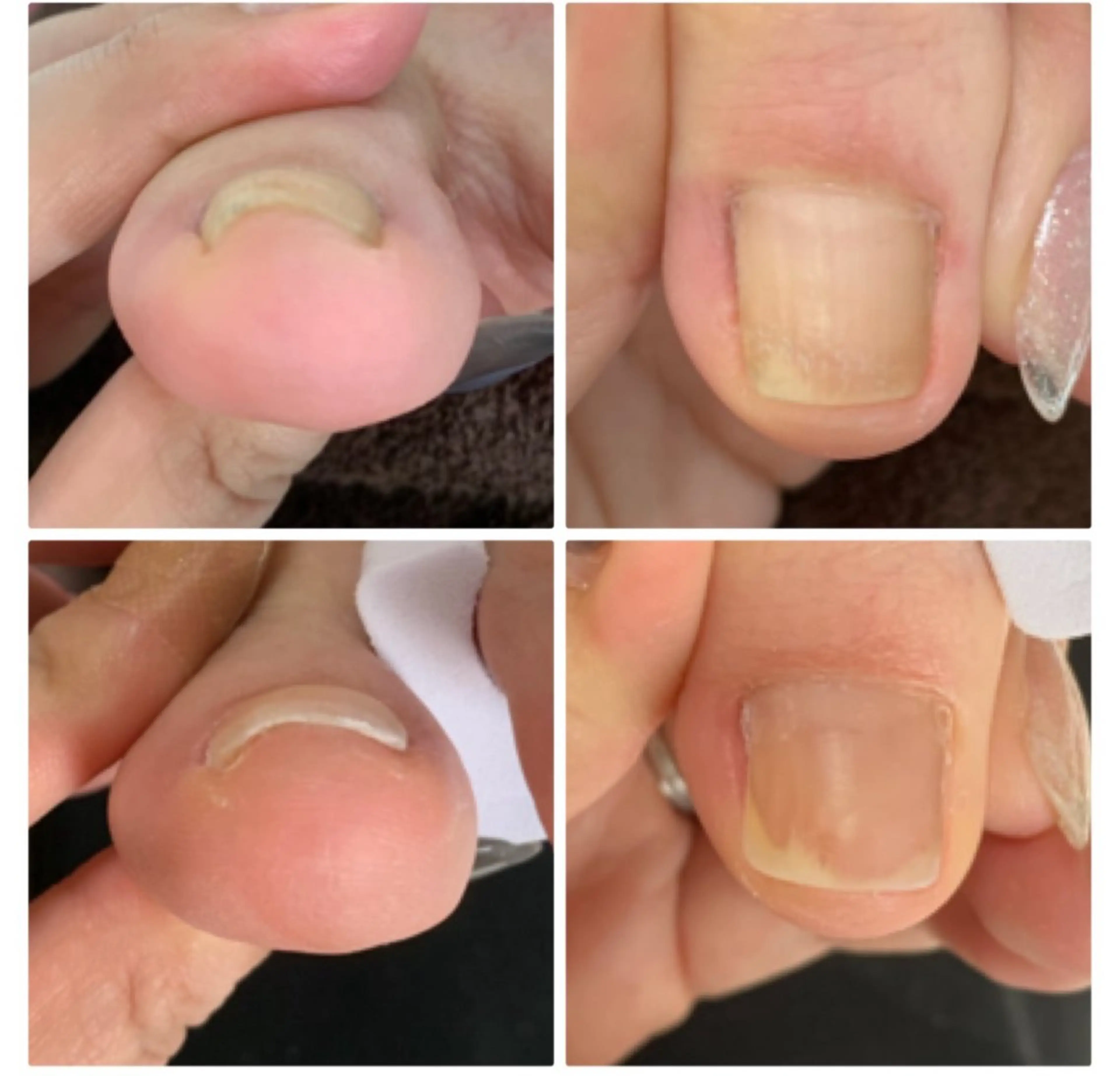 ネイル ネイルサロンエール 店長沼尻のネイルデザイン