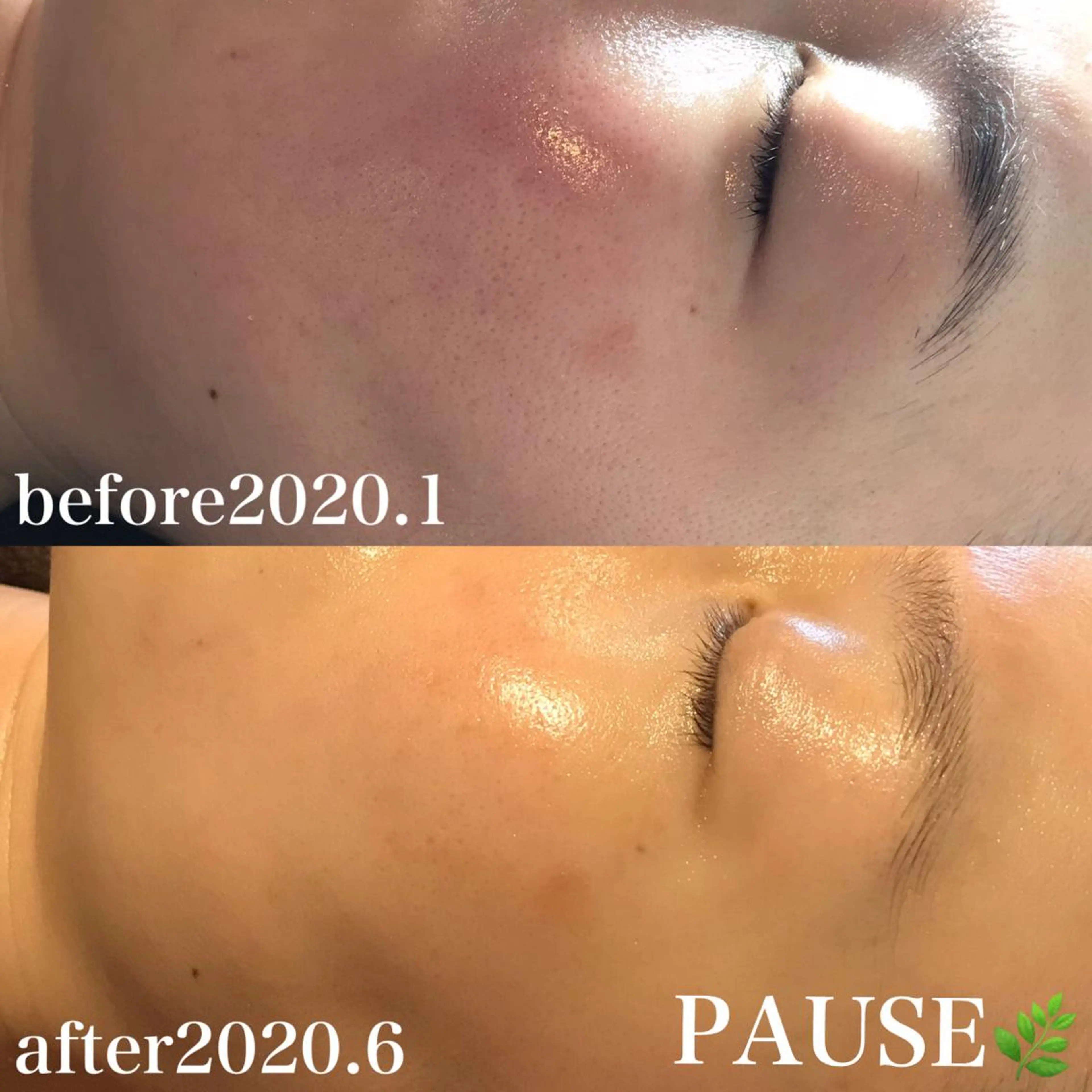 エステ 浜野 恵美のエステ・リラクイメージ