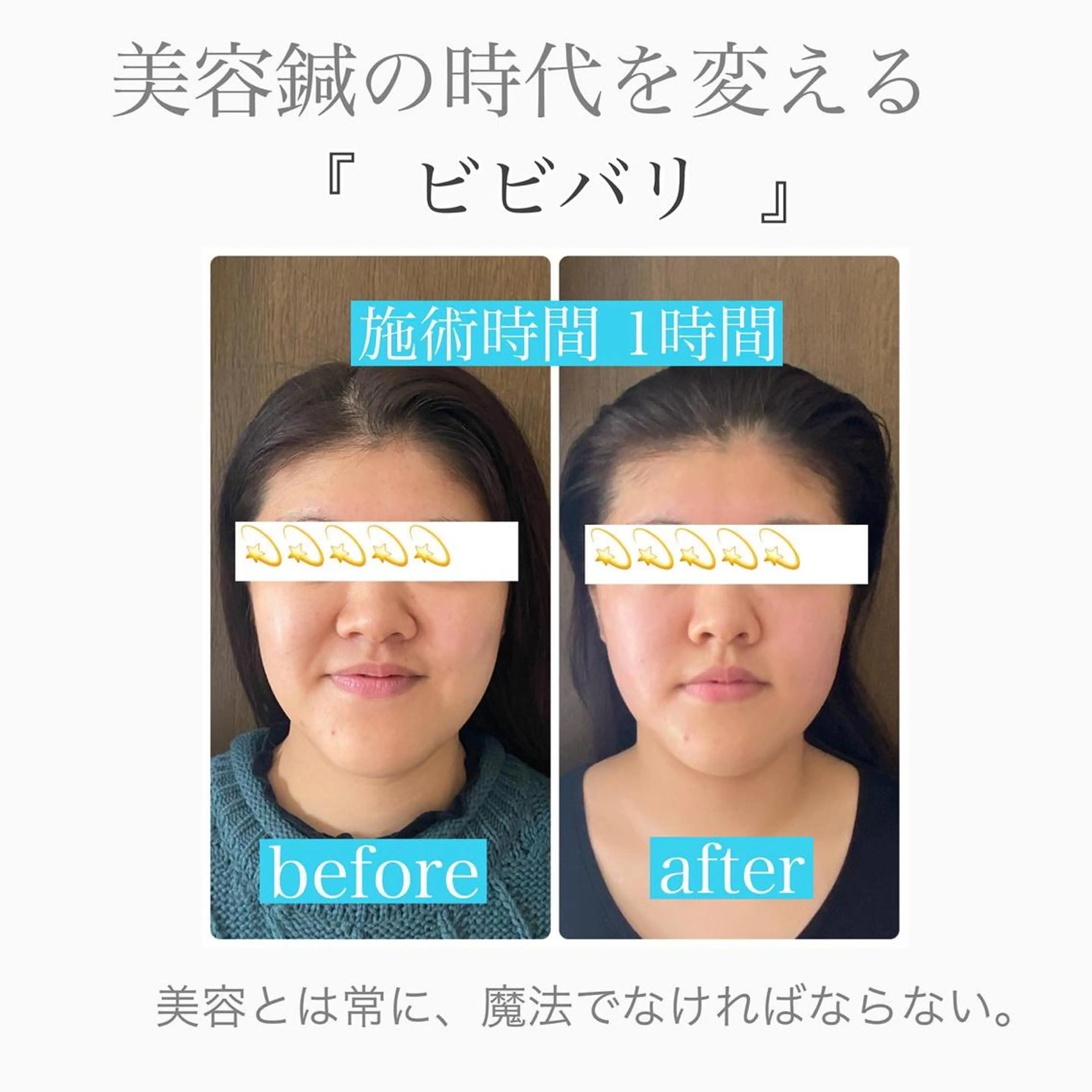 鍼灸サロン BBB3のその他イメージ