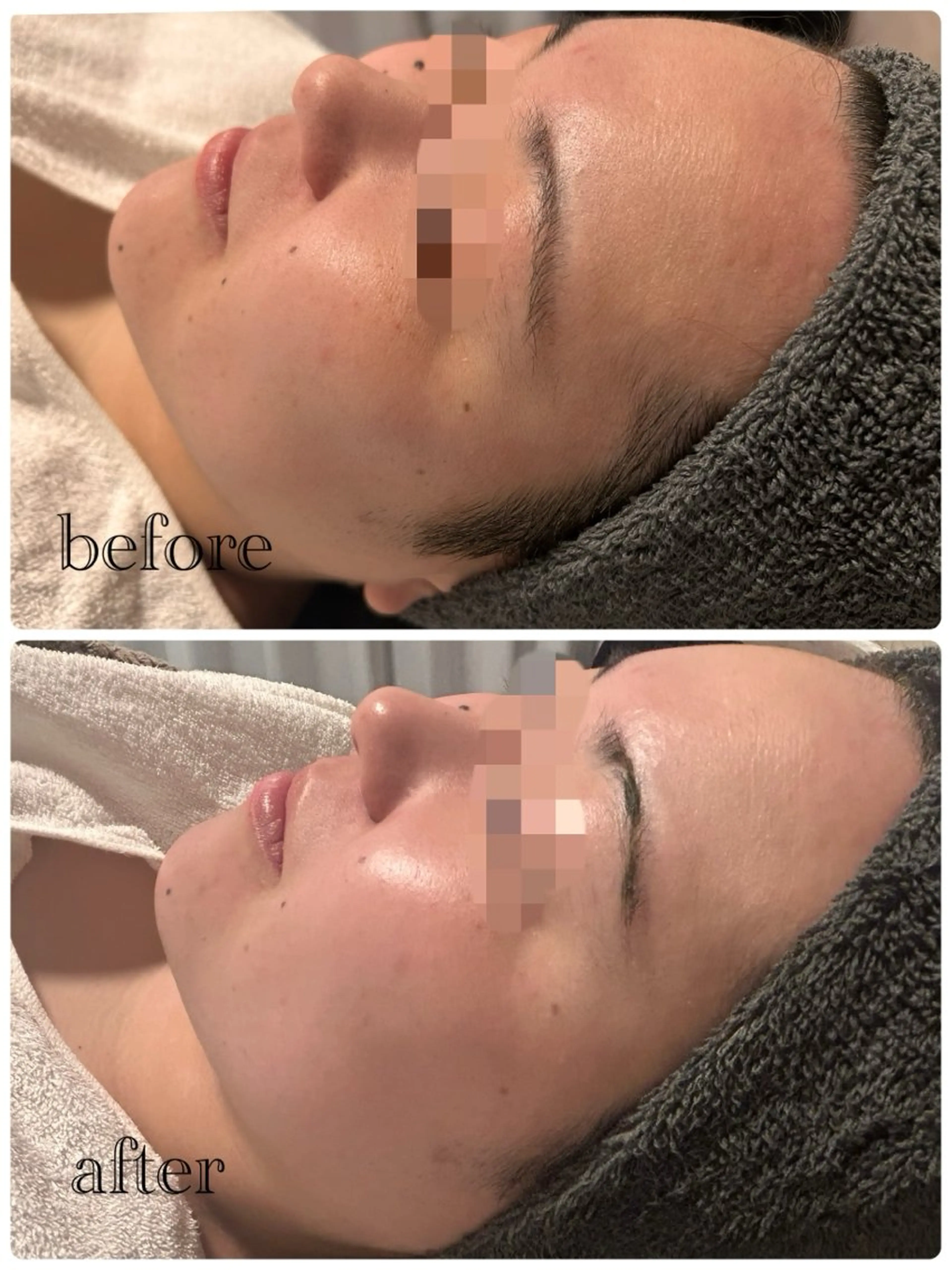 lumi riseのエステ・リラクイメージ