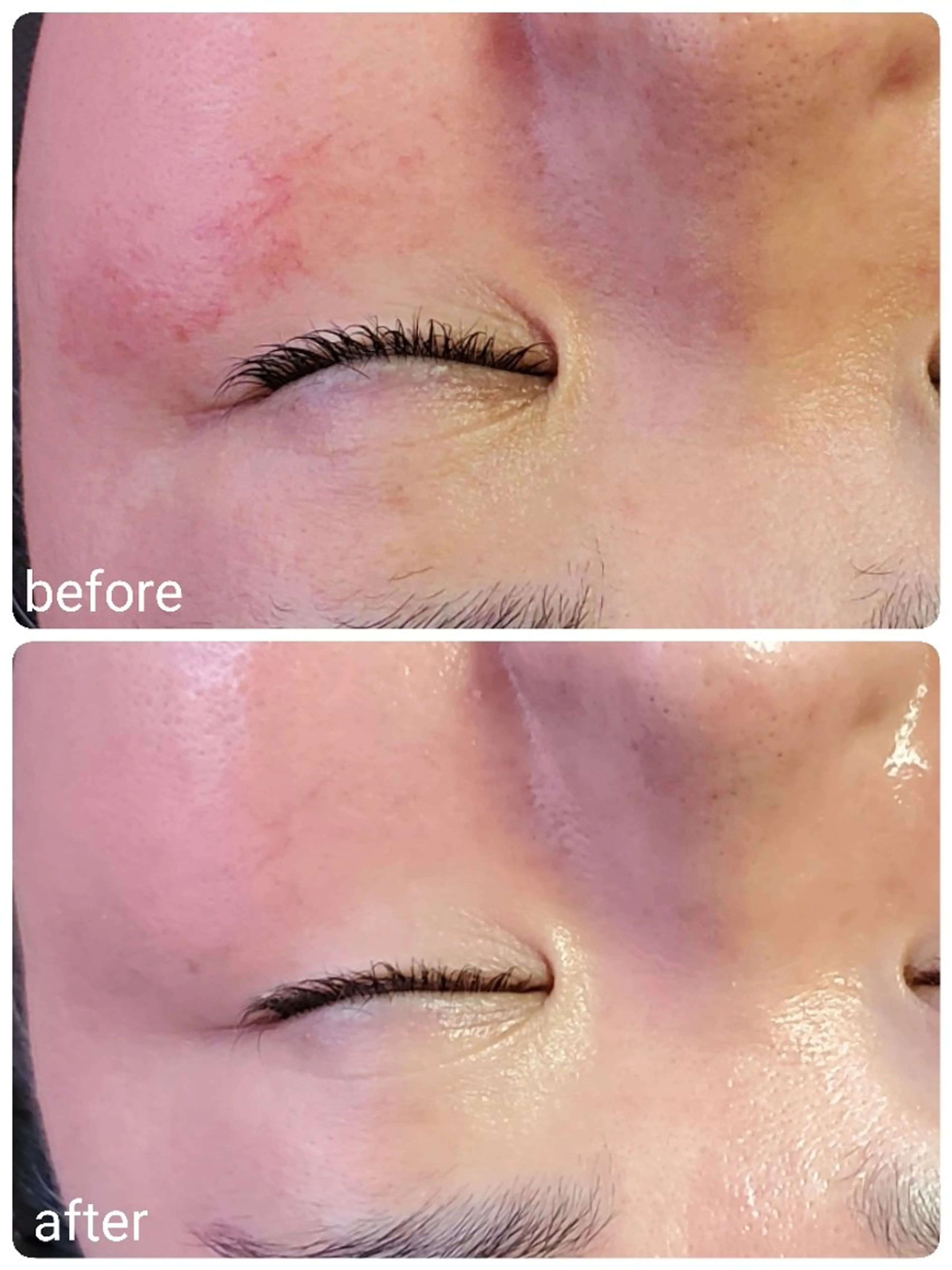 肌悩み解決サロン ハーブピーリングのエステ・リラクイメージ