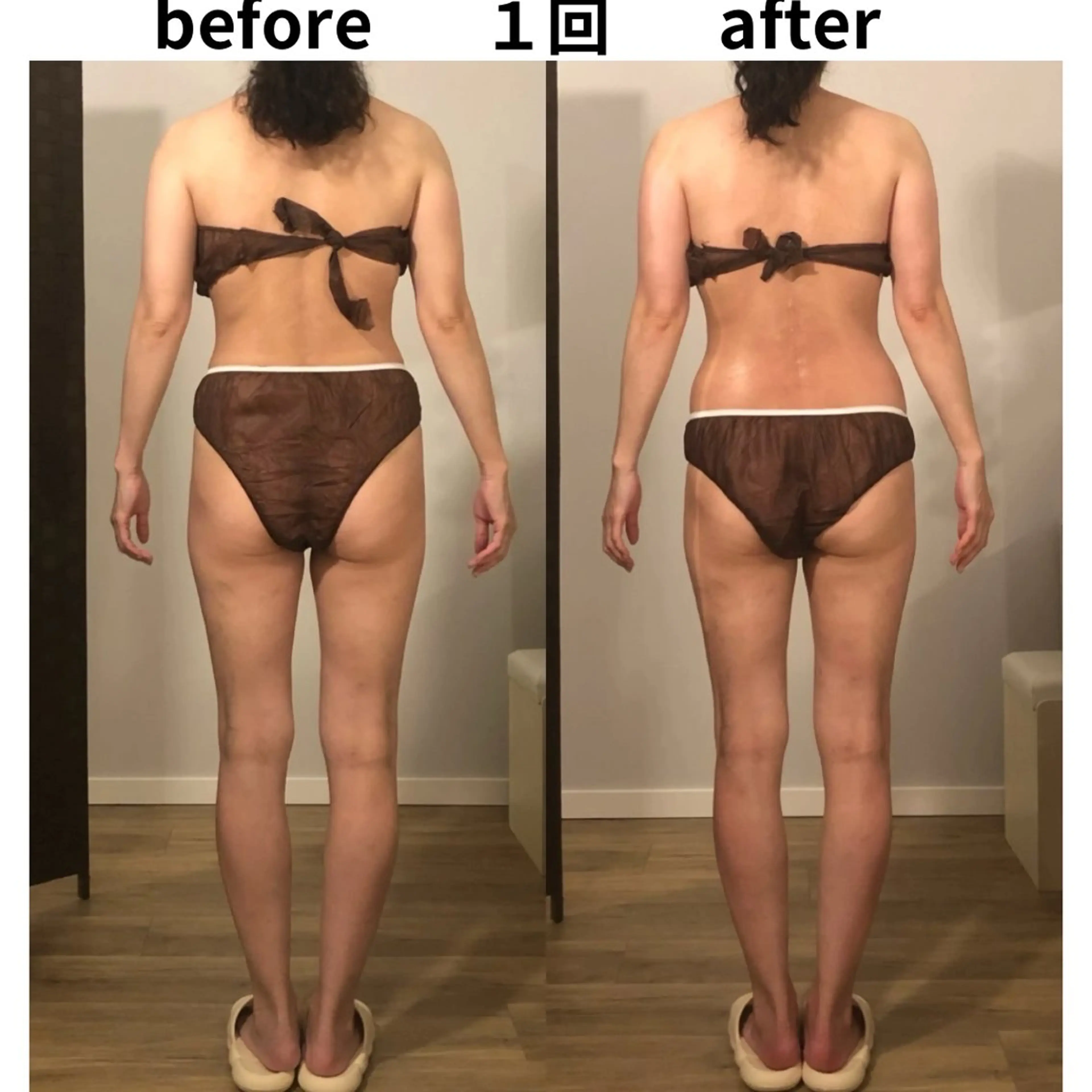 小顔・痩身専門店 Sunao所属・小顔.足痩せ整体 痩身天六Sunaoのその他イメージ