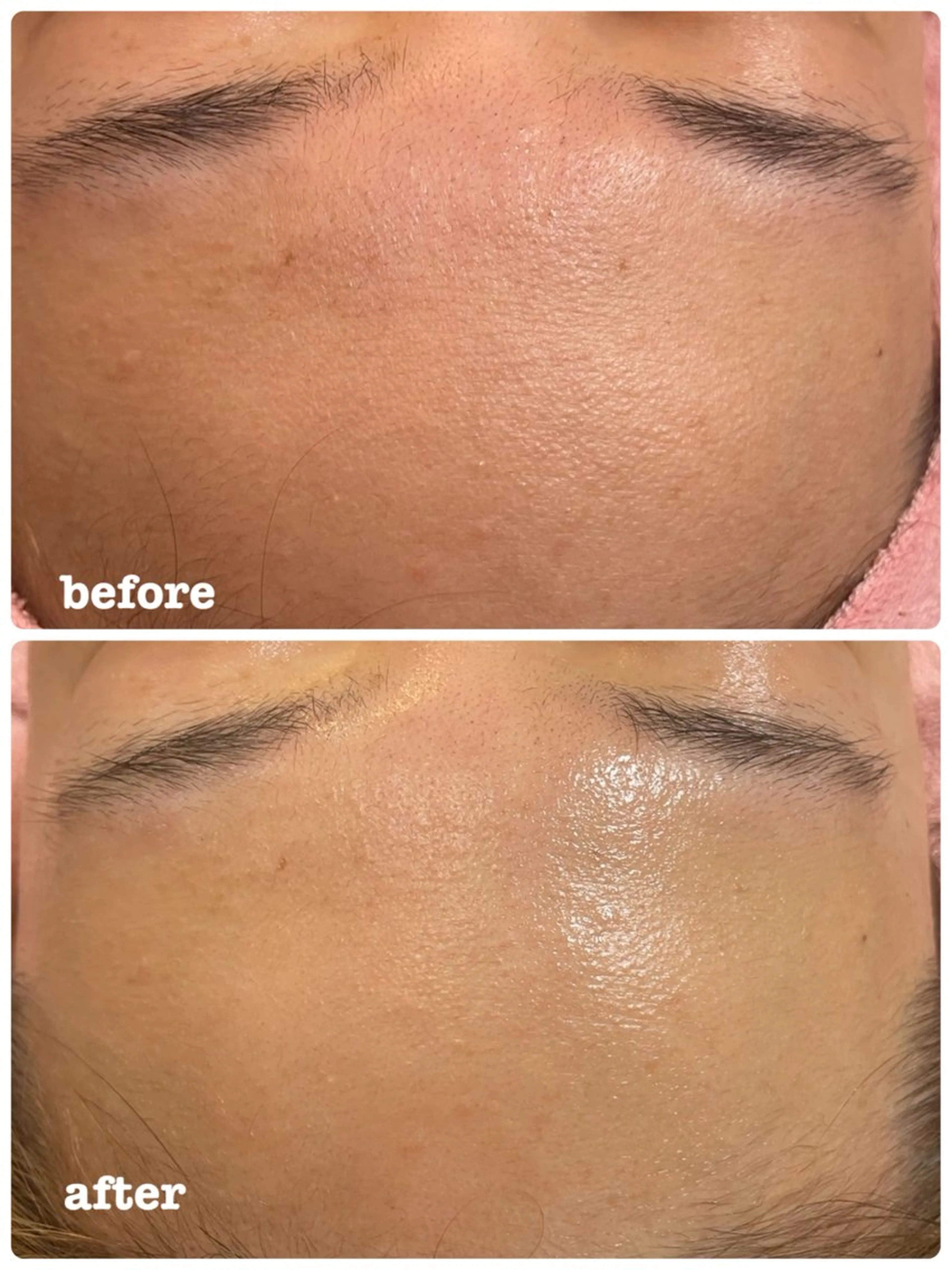 エステ 心満たされる ハーブピーリング絹々のエステ・リラクイメージ