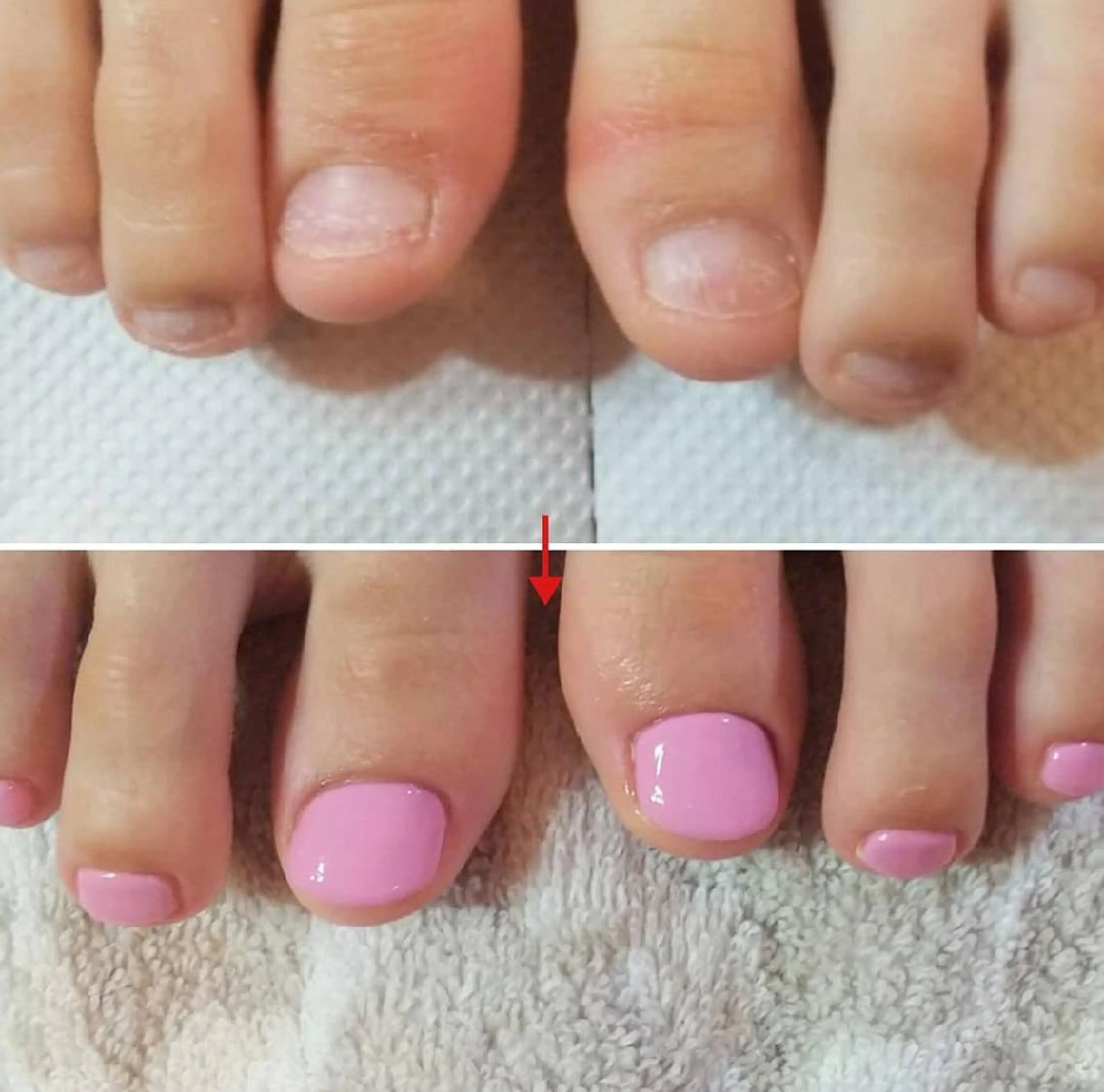 ネイル フットネイル ネイルサロン アリュームのネイルデザイン