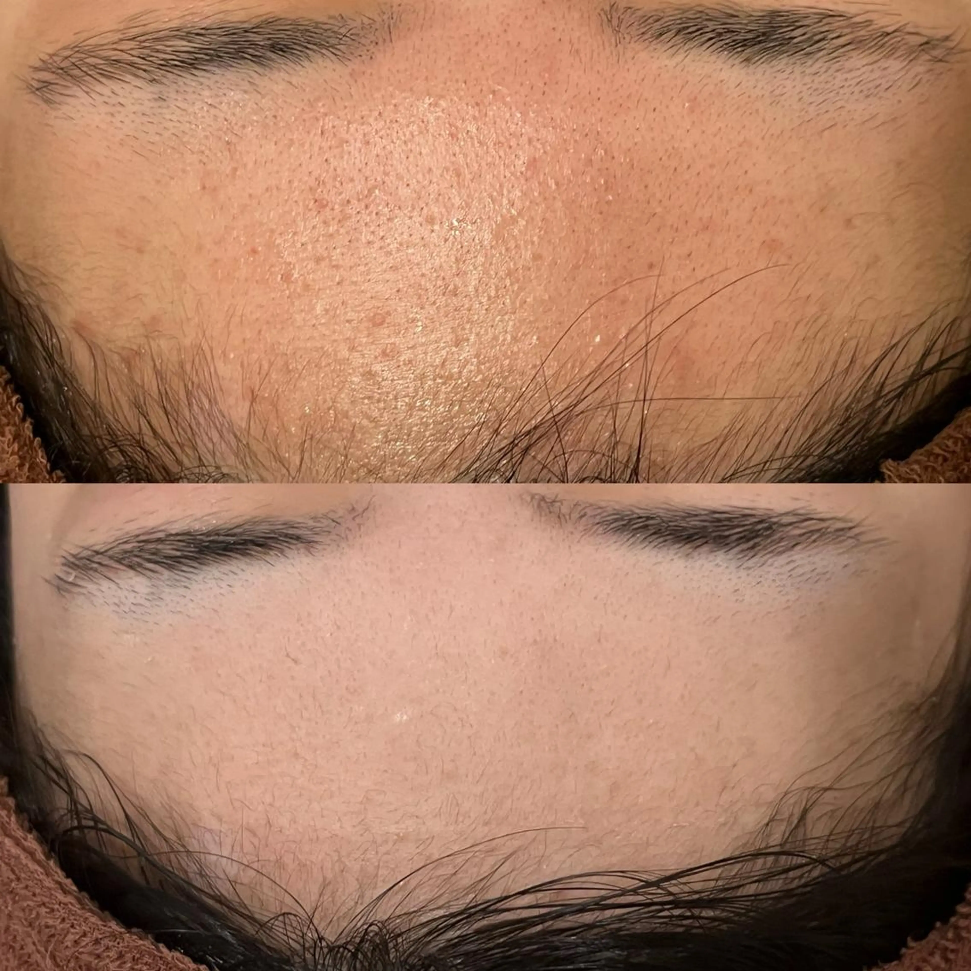 3か月で肌革命👼 ニキビ専門店💫のエステ・リラクイメージ