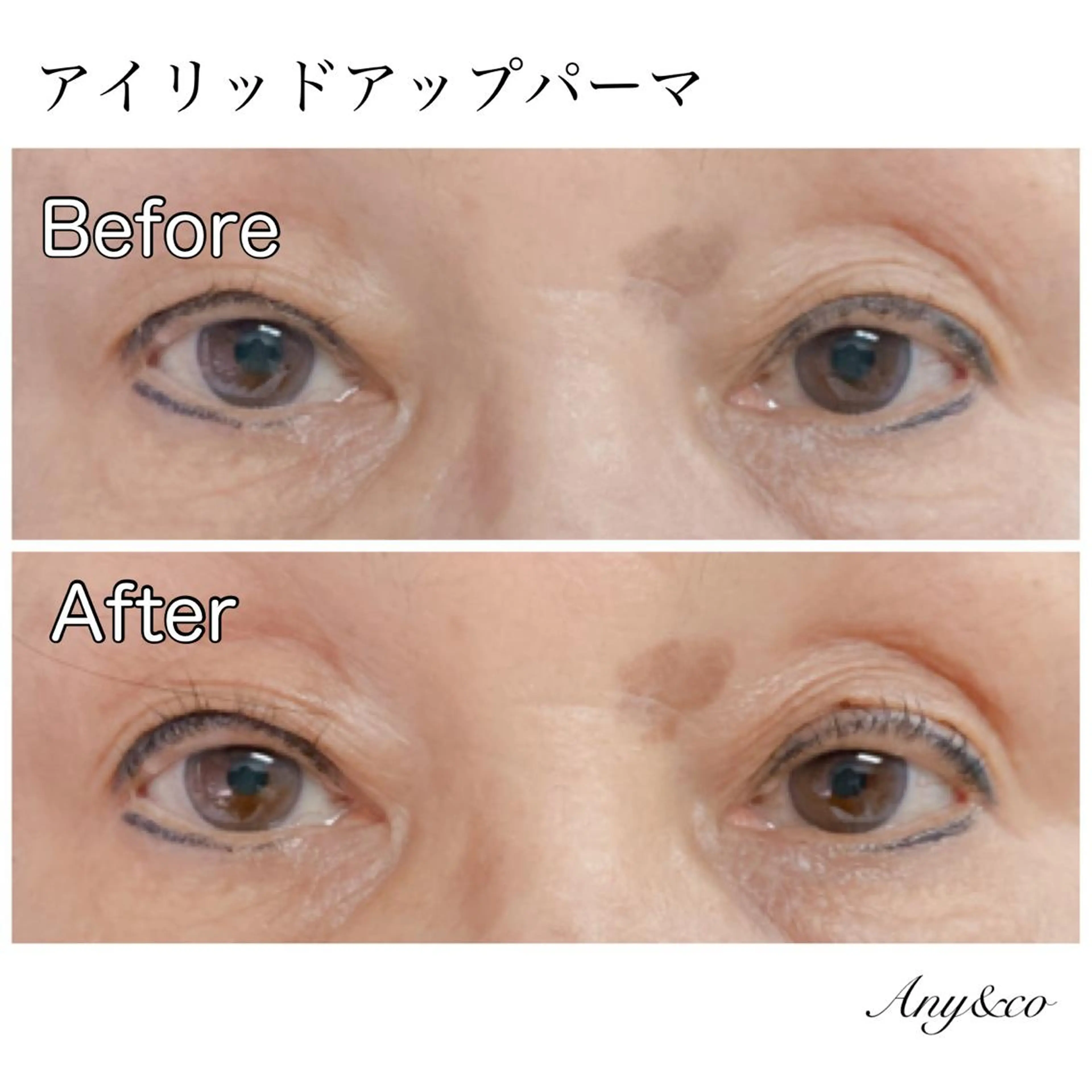 マツエク・マツパ アイリッドアップパーマ Any&co 【エニコ】のマツエク・マツパデザイン