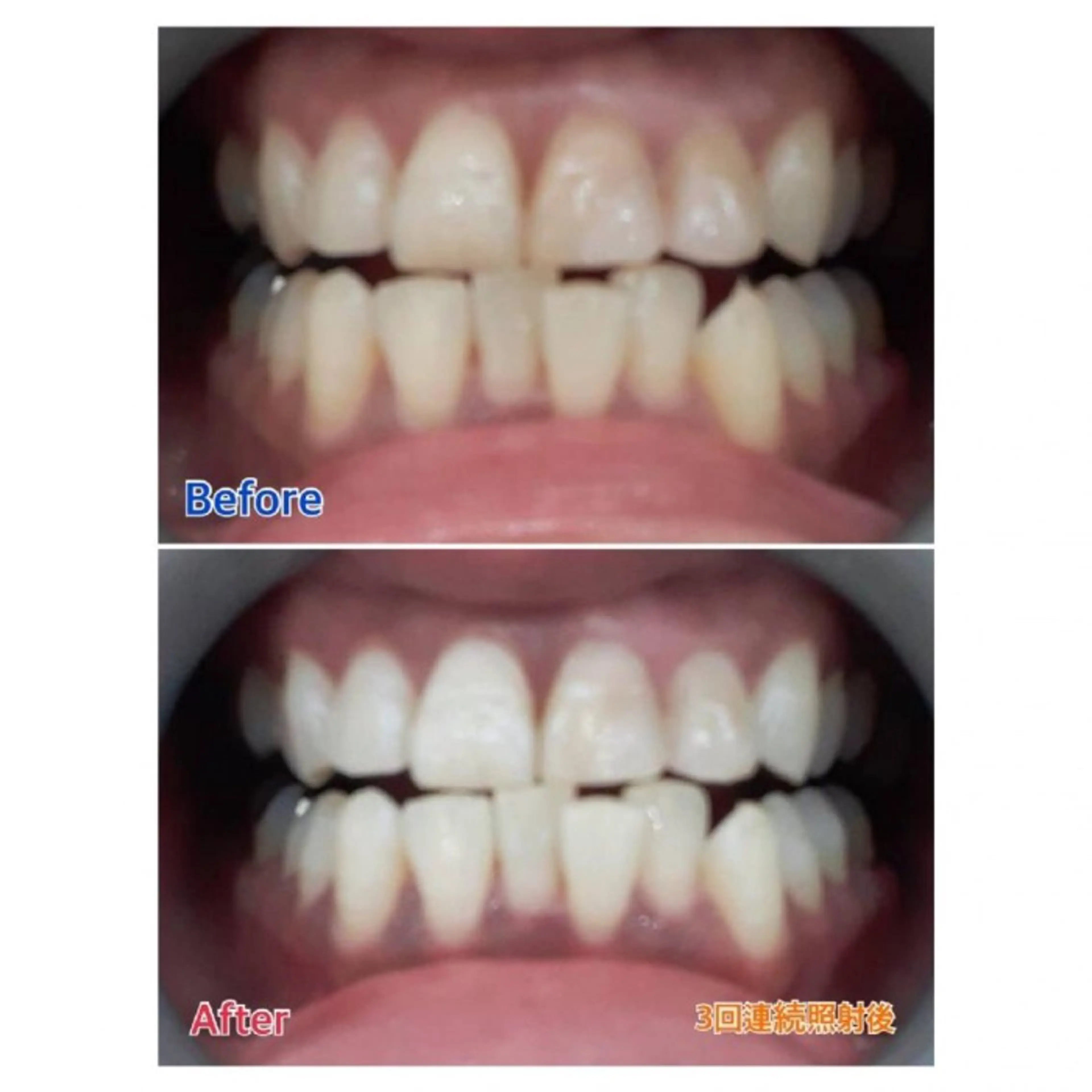 Ｍ渋谷 ホワイトニングのエステ・リラクイメージ