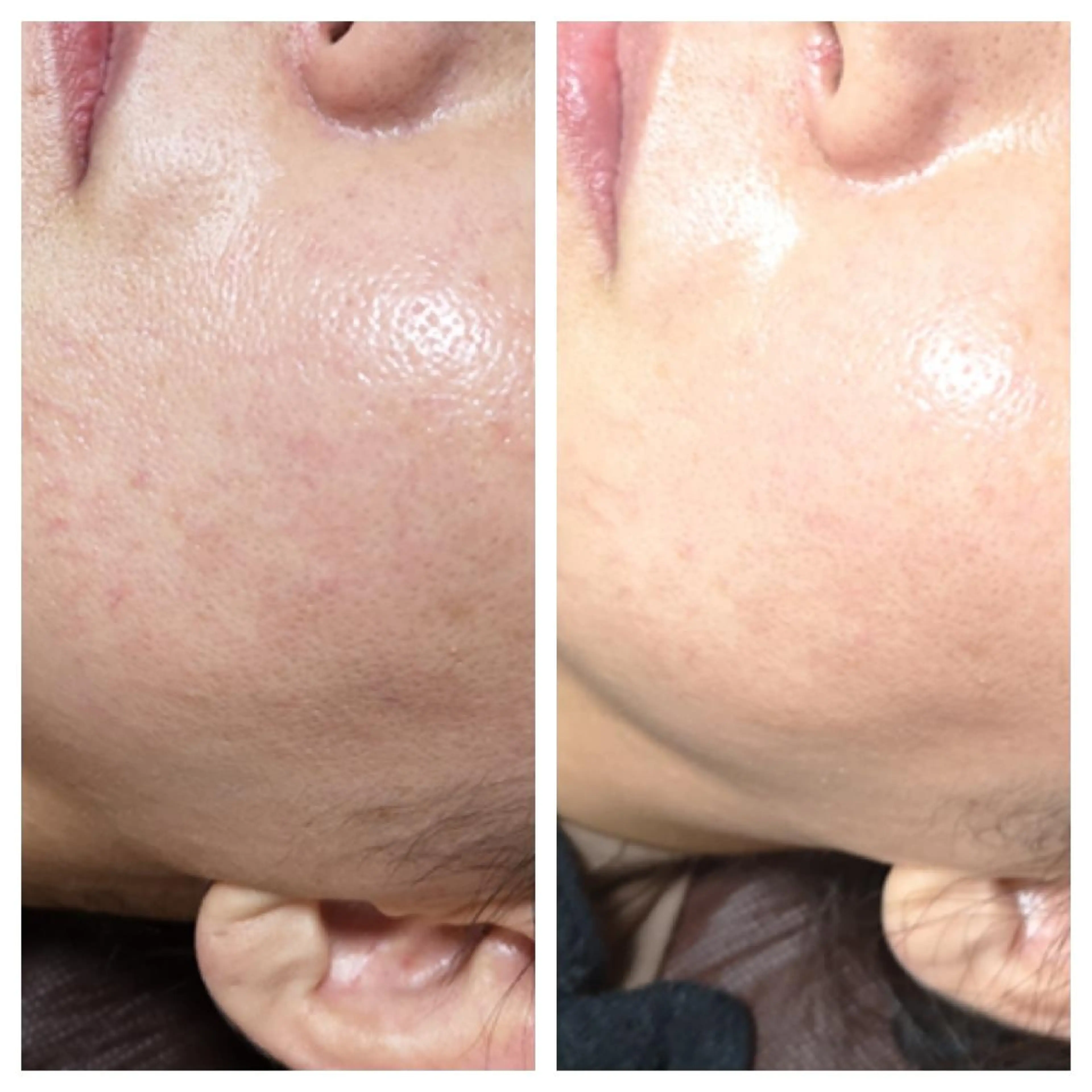 🅖🅤🅩🅔🅛 salonのエステ・リラクイメージ